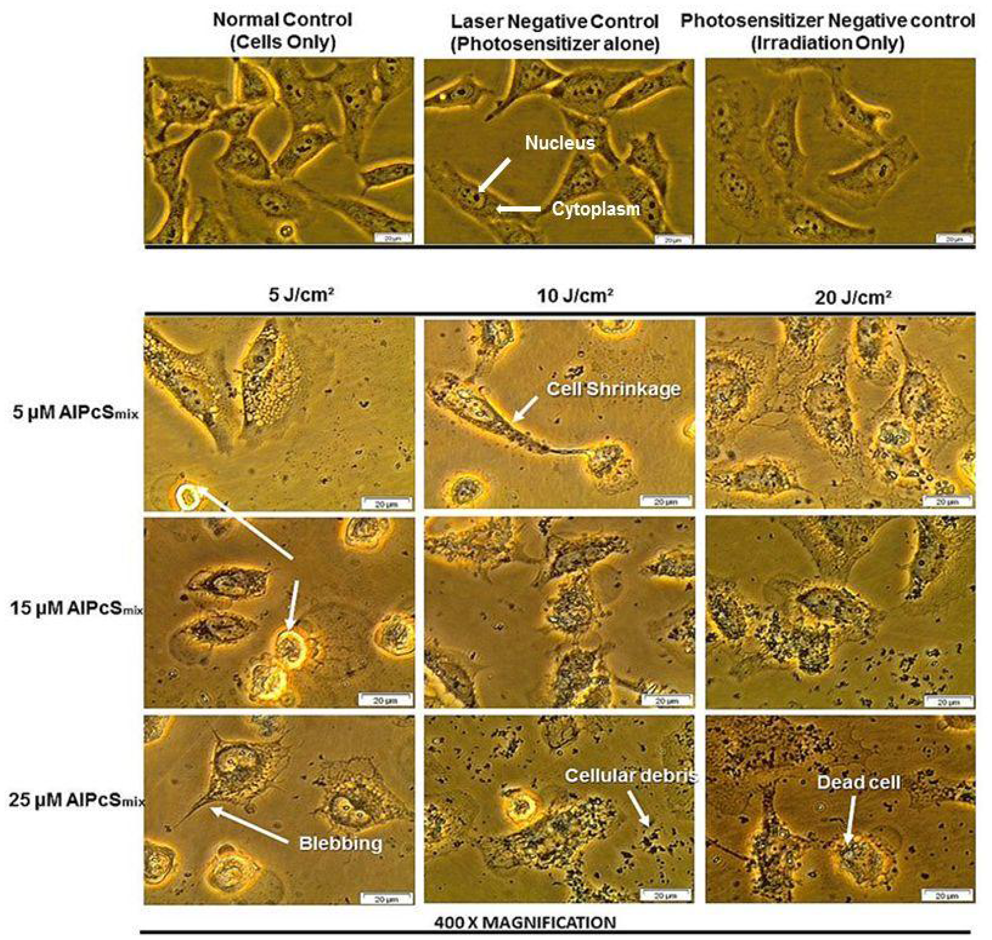 Cellular morphology of HeLa total population as seen under 400× magnification demonstrating unaltered structure of cells in the control group and groups treated with either of the variables alone and notable distortion in structure in PDT treated cells.