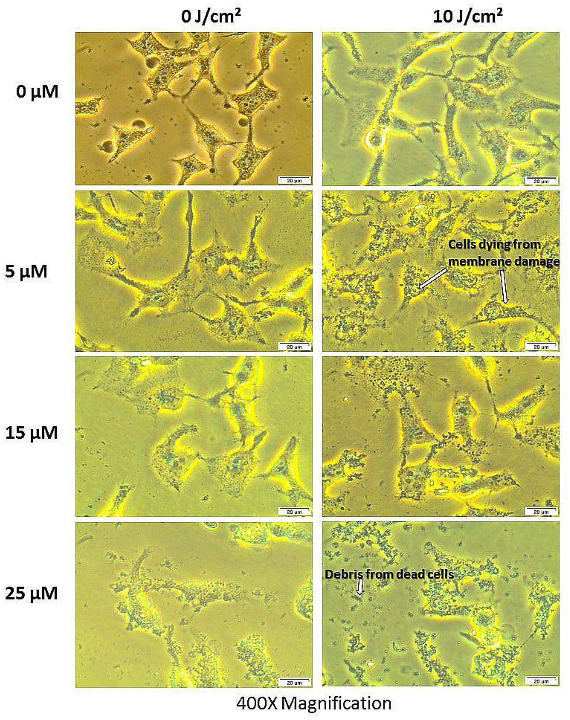 Cellular morphology of the side population showing unaltered structure of cells not treated with either of the variables alone and notable structural changes in PDT treated cells as seen using 400× magnification.