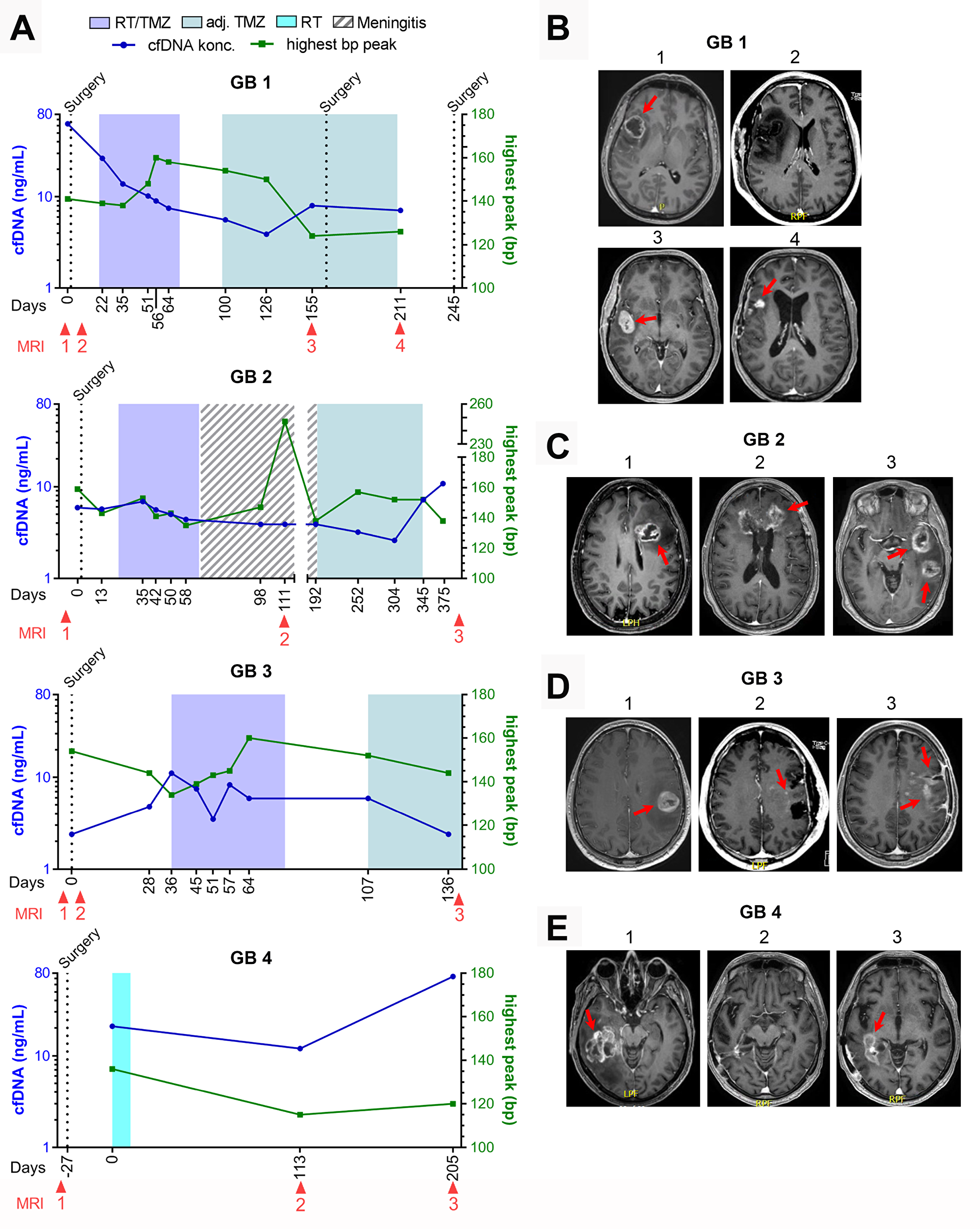 GB1-4 with progression.