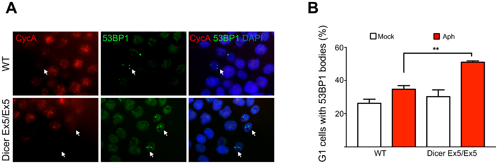 Dicer inhibition causes increase in 53BP1 nuclear bodies.