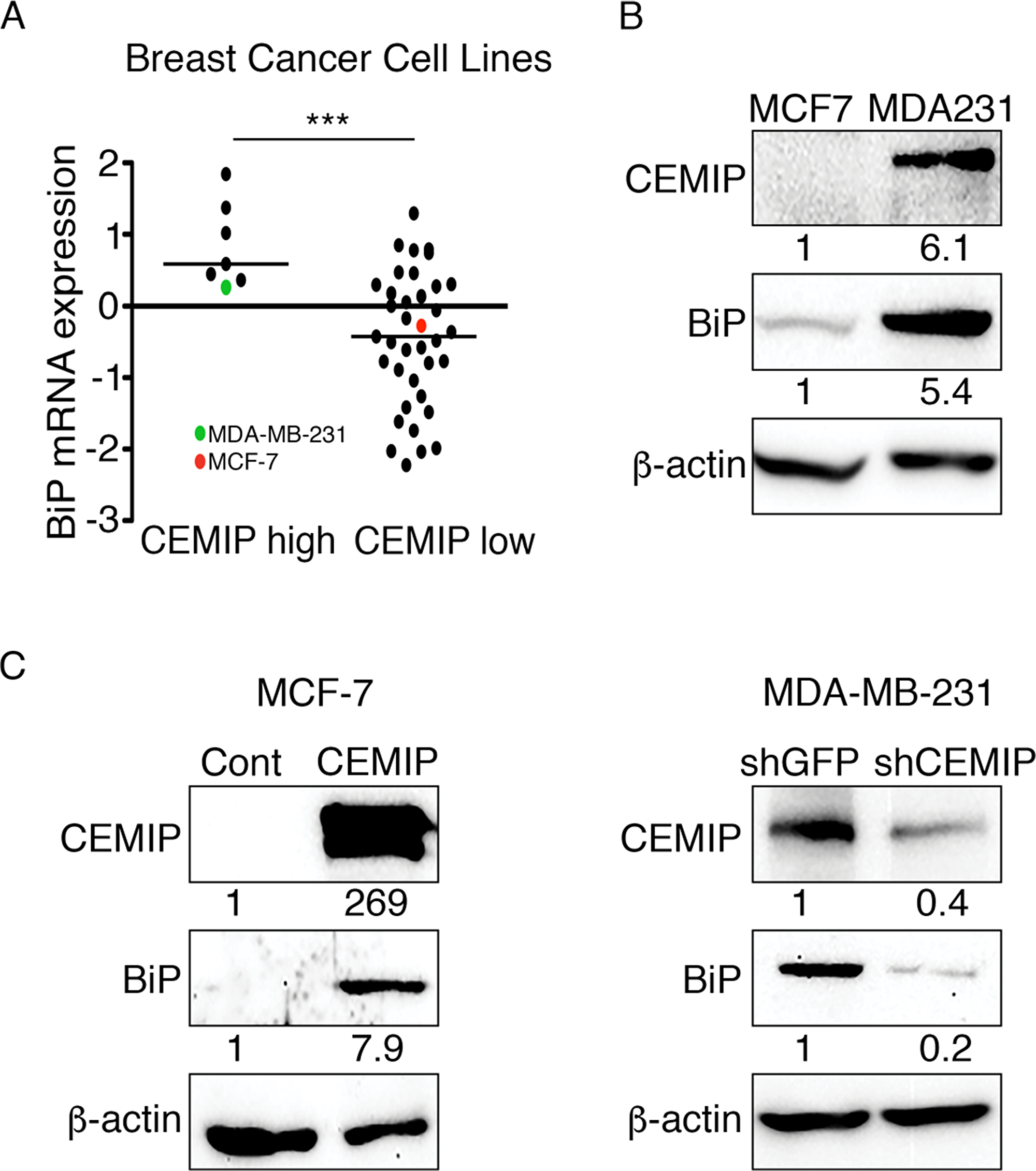 CEMIP upregulates BiP in human breast cancer cell lines.