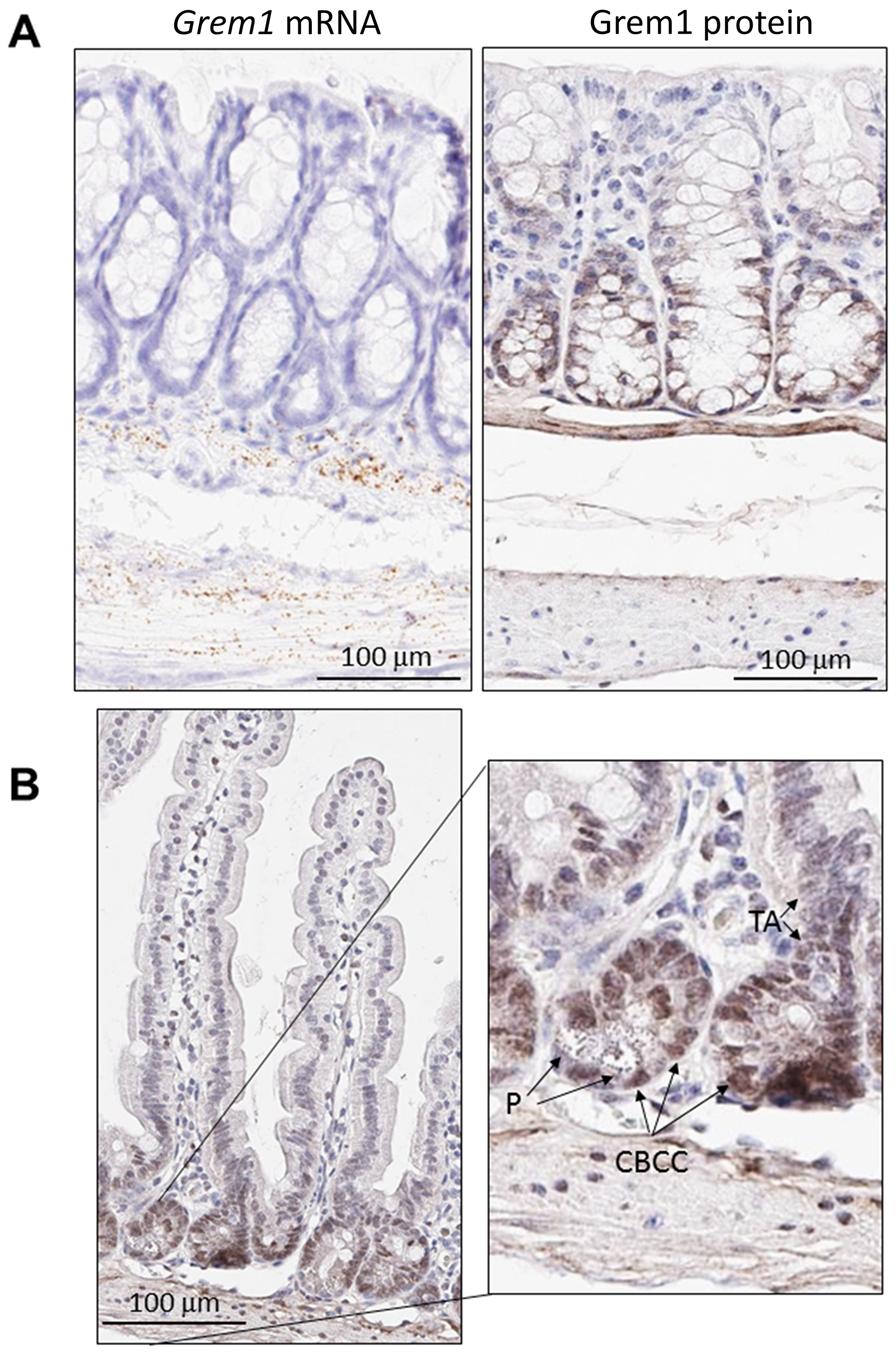 Distinct pattern of endogenous Grem1 expression in mouse colon.