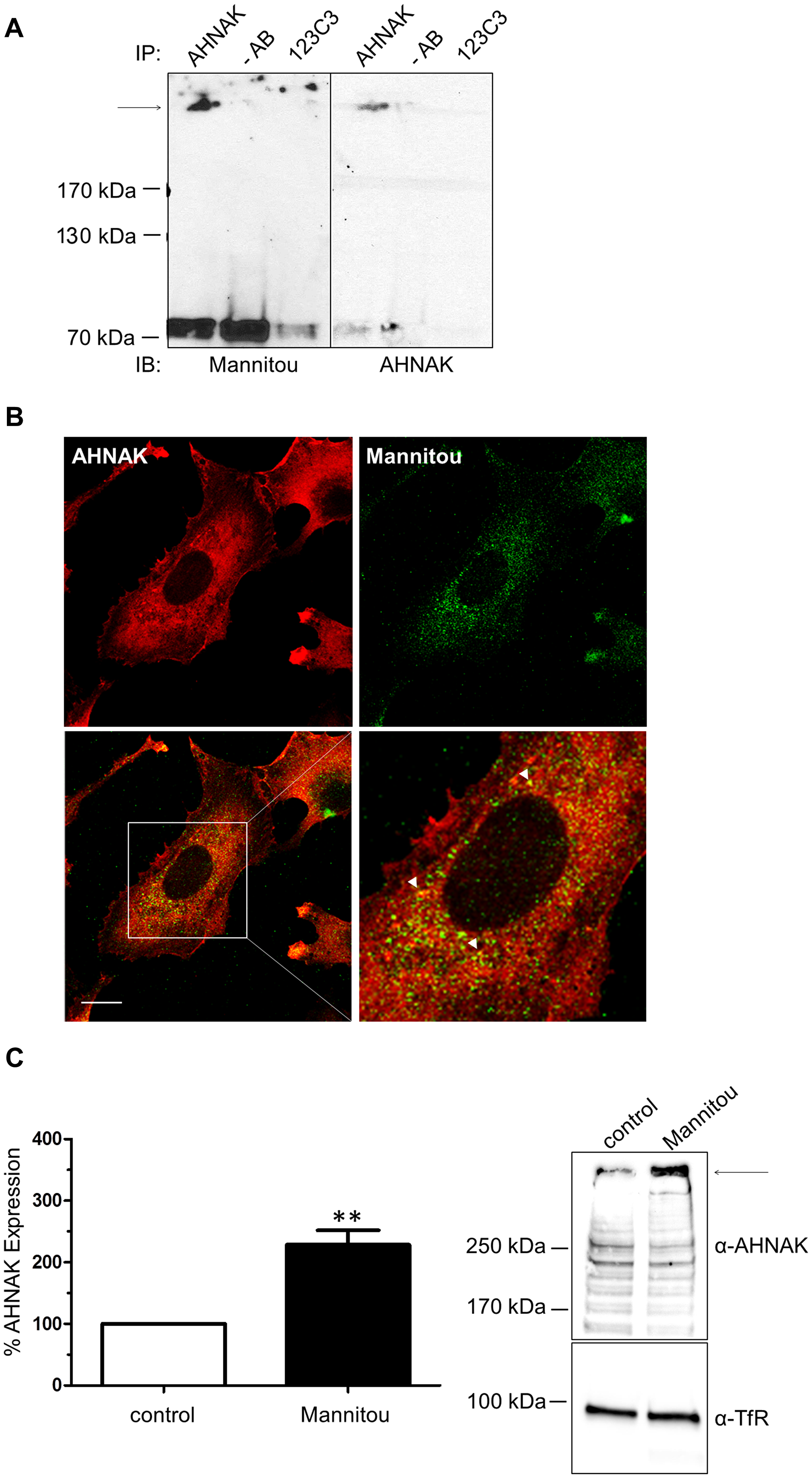 AHNAK carries paucimannose and is upregulated by Mannitou antibody.