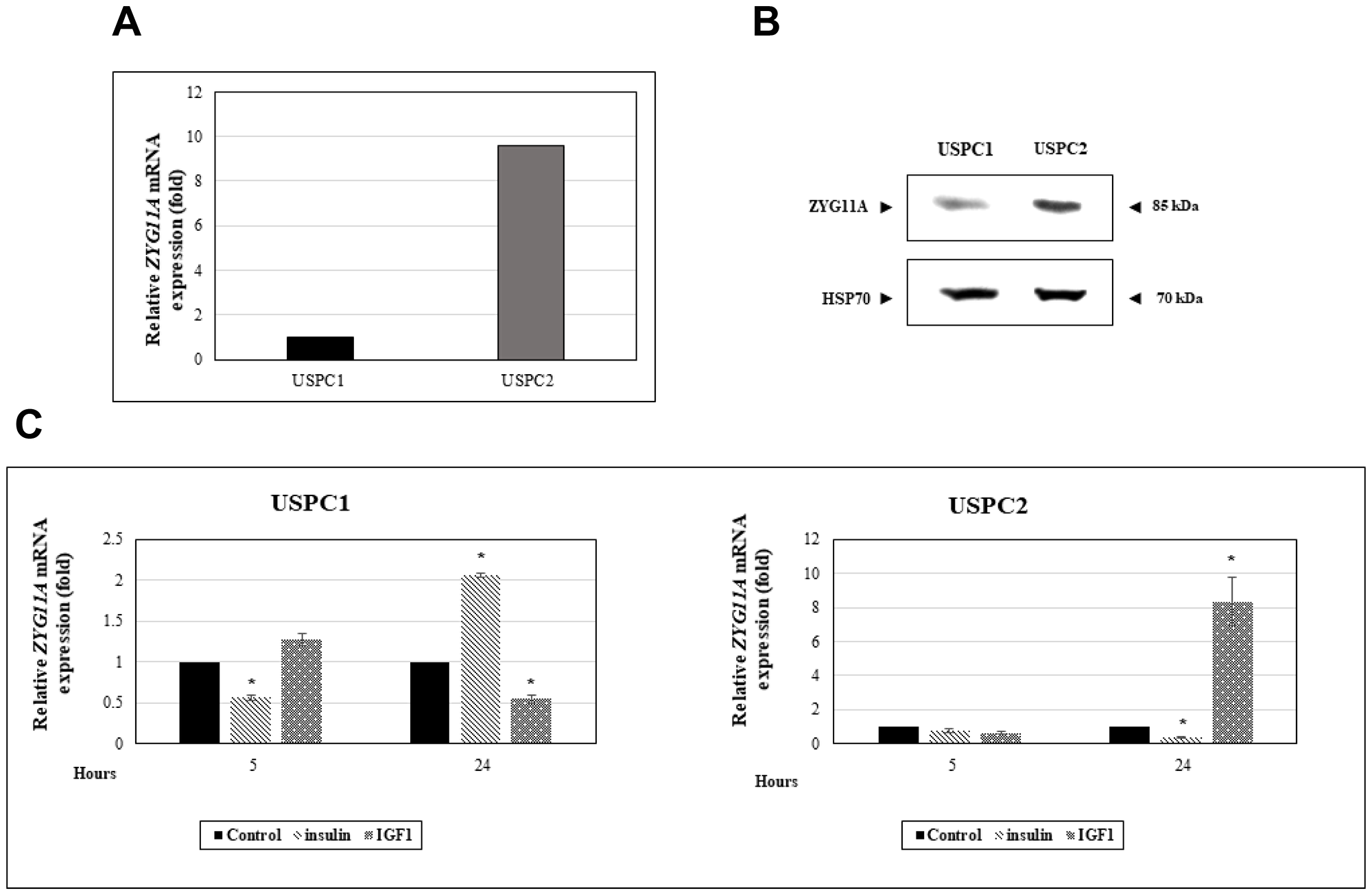 Regulation of ZYG11A gene expression by IGF1 in endometrial cancer cells.