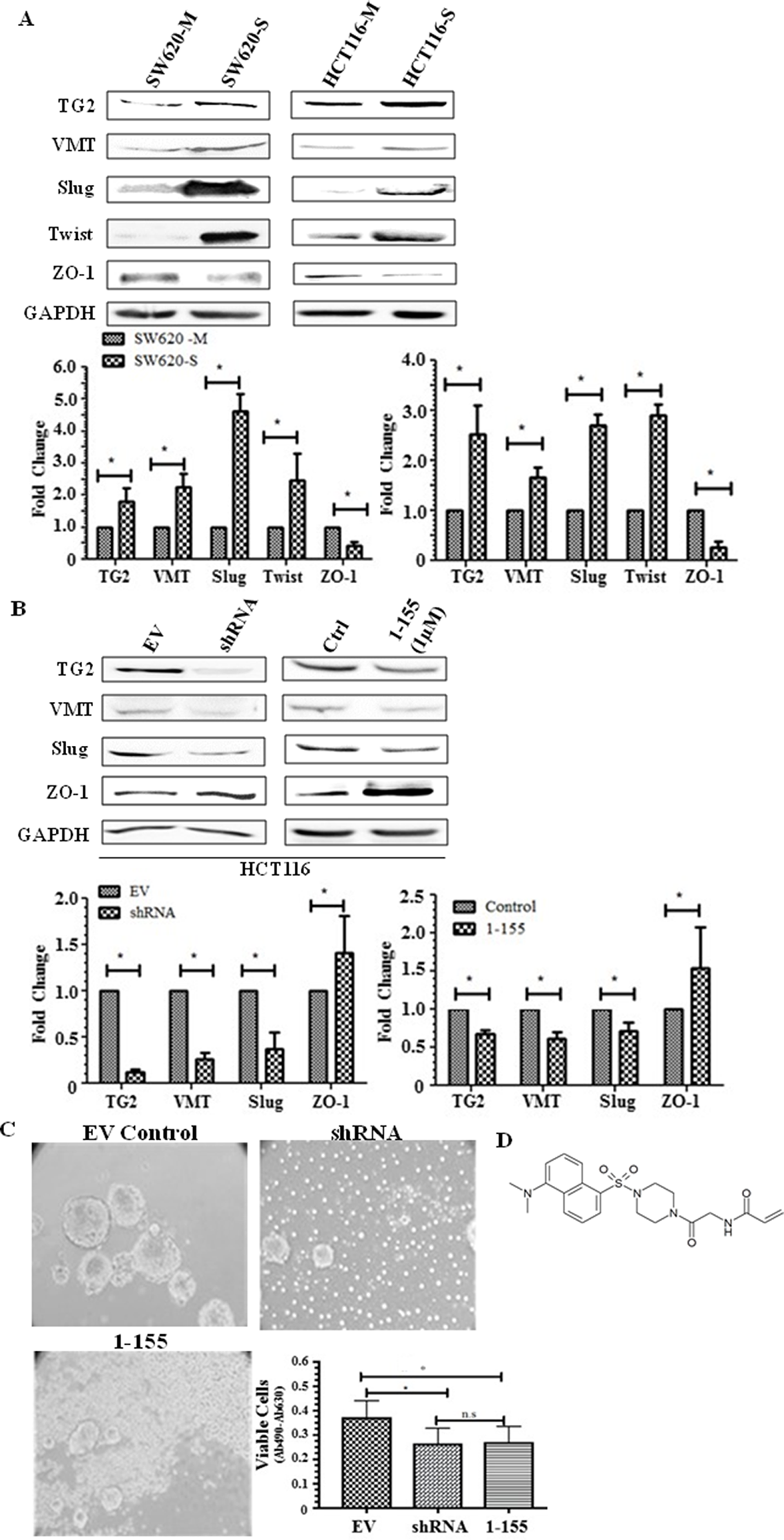 TG2 and EMT is upregulated in spheroid cells with stem cell-like properties.