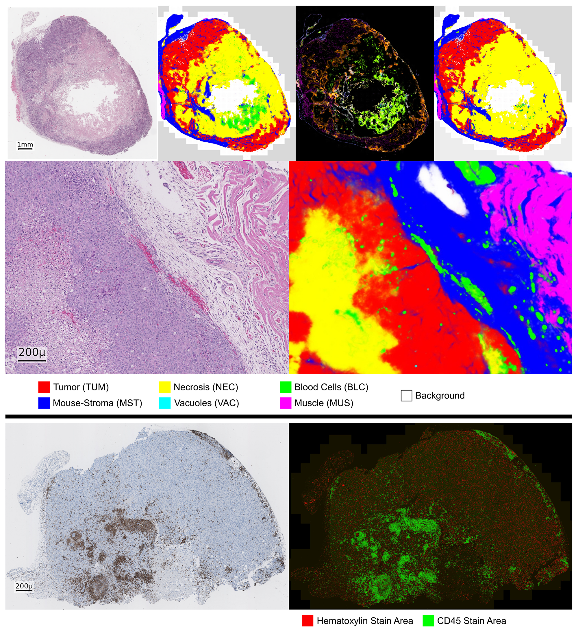 Prediction of the HistoNet architecture on an input sample (NSCLC PDX).