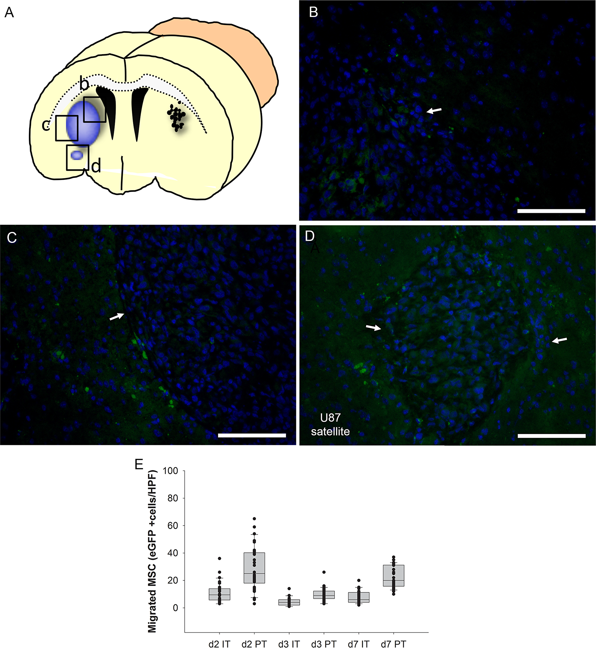 Time course analysis of intratumoral (IT) and peritumoral (PT) accumulation in the intracerebral human U87 glioblastoma model after injection of eGFP-expressing MSCs (green) into the contralateral hemisphere (A). Two days after injection MSCs enriched at the tumor site with intratumoral (B) and peritumoral (C) hot spots. Even a tumor satellite distant from the main tumor mass was peritumorally encircled by MSCs (D). The majority of MSCs was found in the immediate peritumoral area after two days (E, box whisker chart). Arrows = tumor border. Scale Bars: 100 μm.