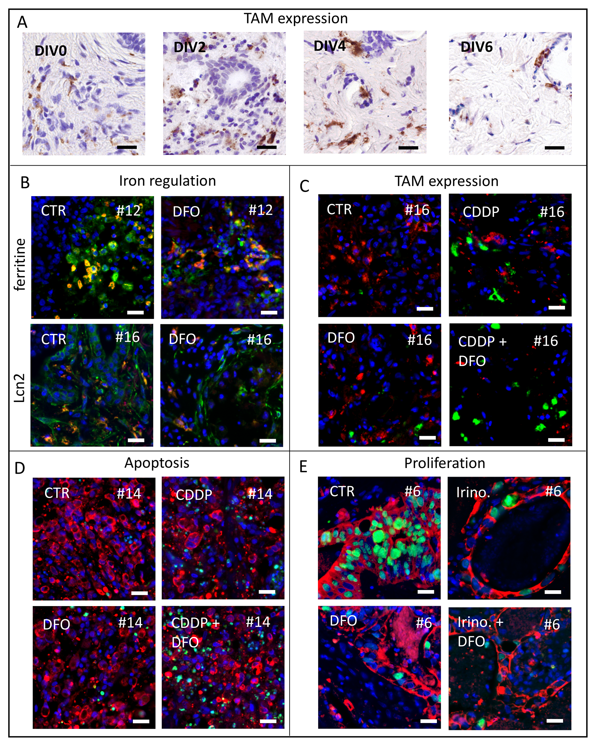 Representative pictures of analyzed human tumor slice cultures.