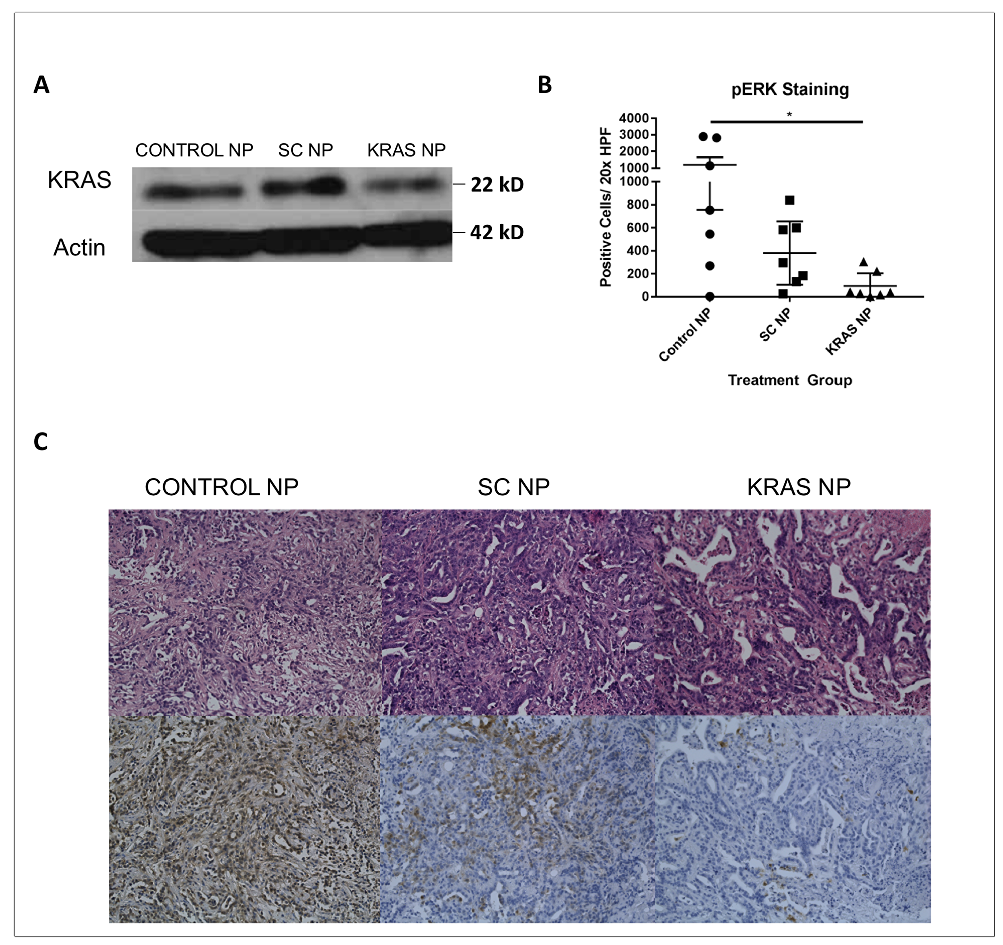 Tumors treated with KRAS siRNA NP demonstrate knockdown of the KRAS signaling pathway.
