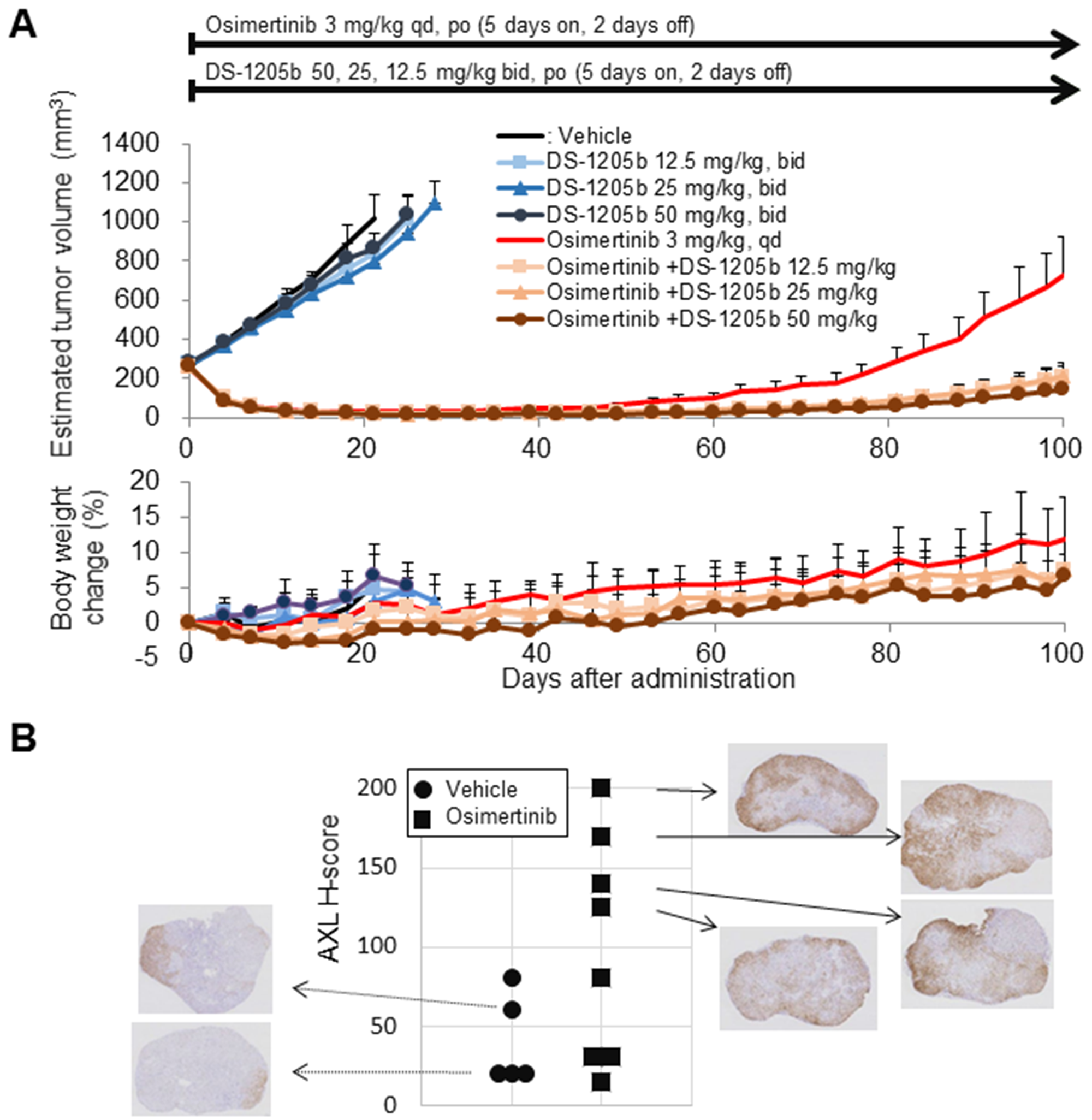 DS-1205b delays osimertinib-acquired resistance in an HCC827 sc xenograft model, and the underlying mechanism