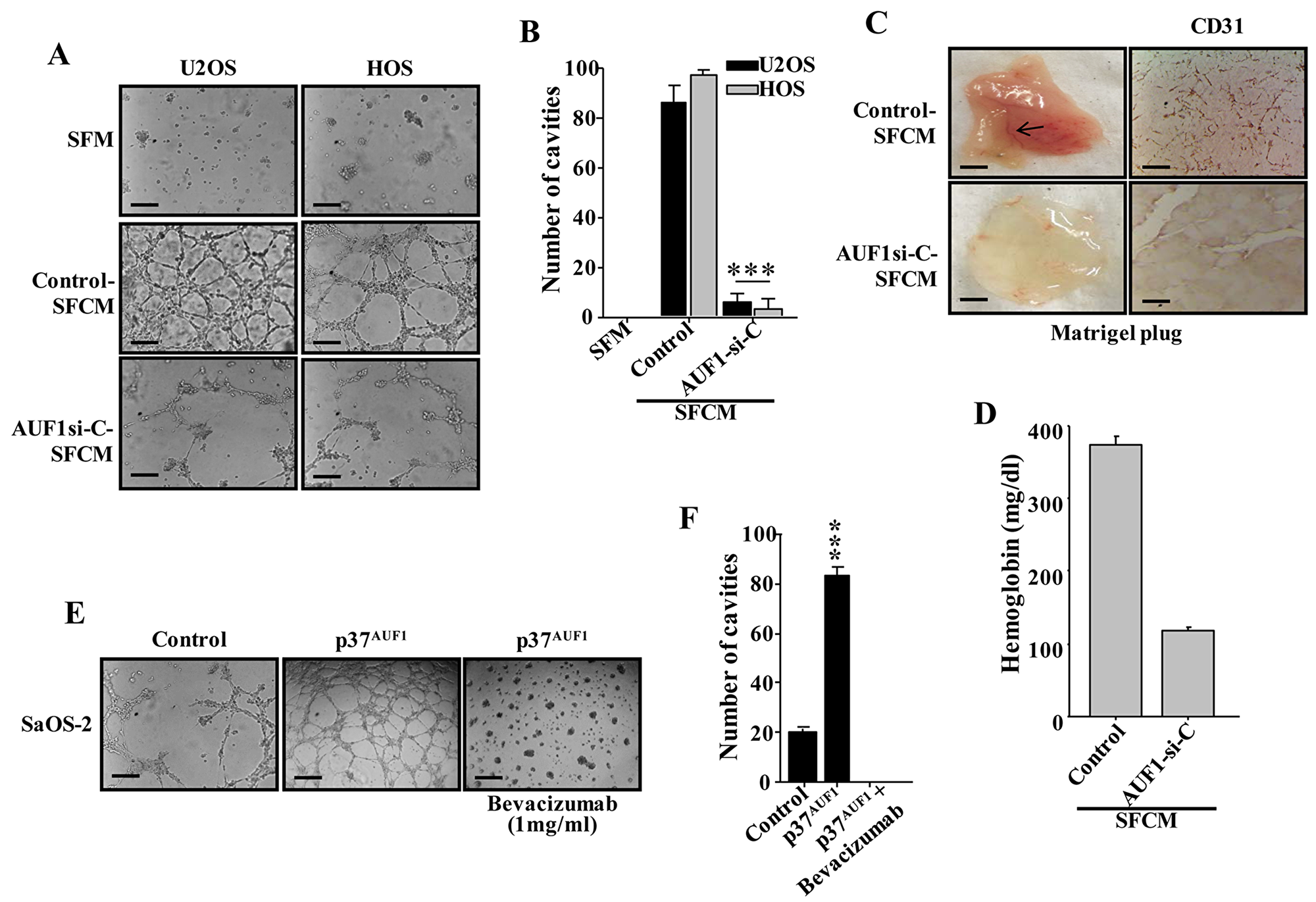 AUF1 enhances the capacity of osteosarcoma cells in promoting endothelial differentiation and angiogenesis in a VEGF-A-dependent manner.