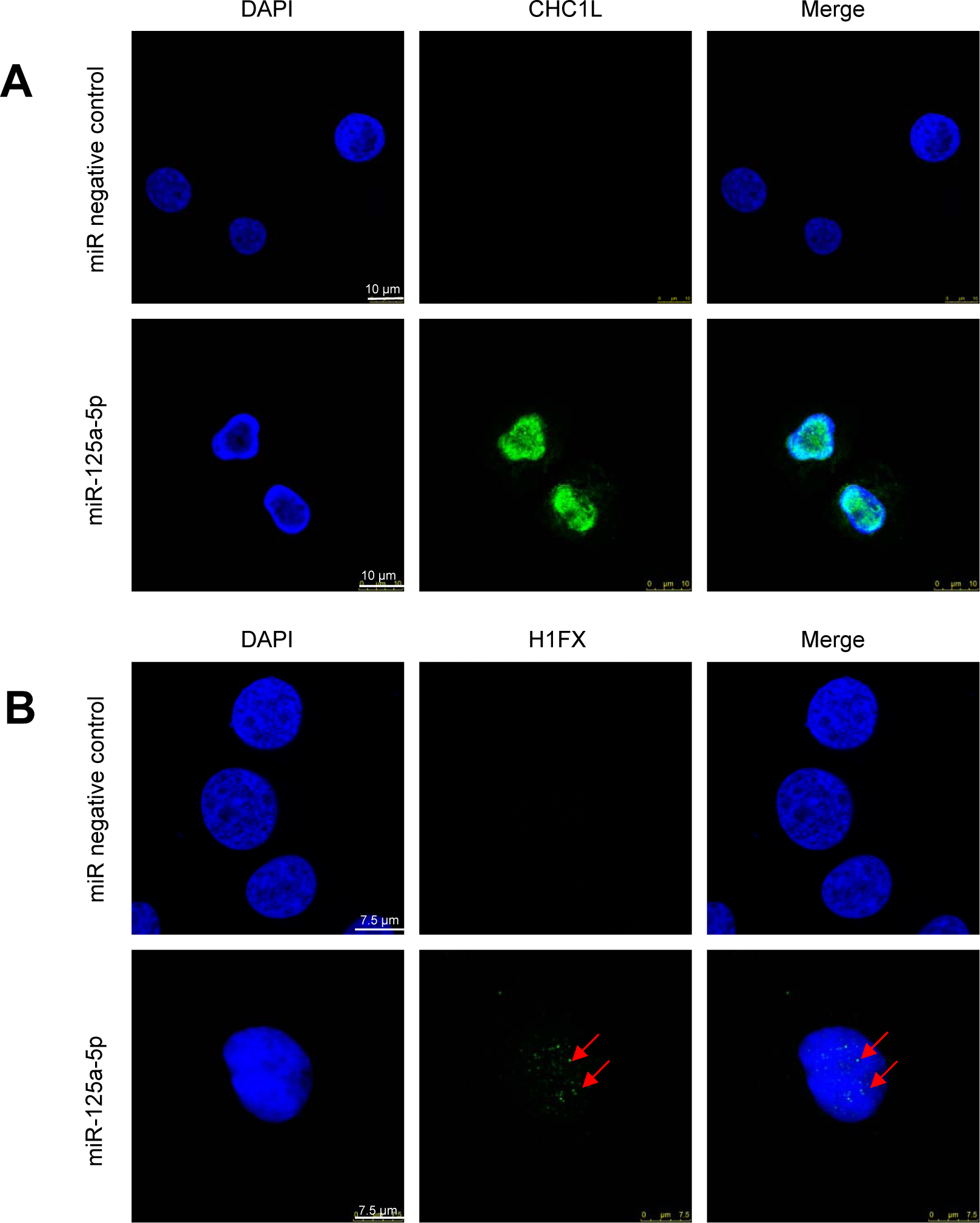 Confocal microscopy for the expression of CHCL1 and H1FX in HL-60 cells following miR-125a-5p ectopic expression
