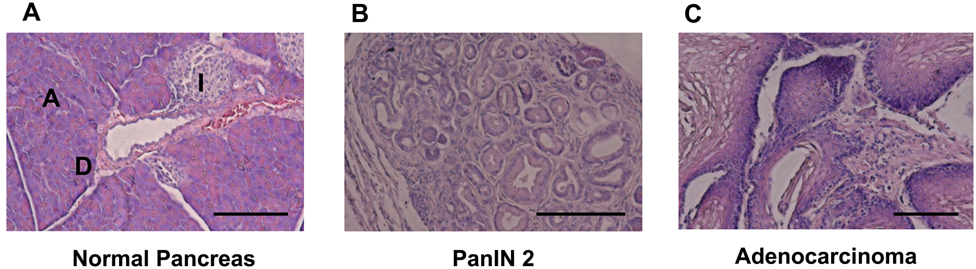 HE staining for pancreatic tissue