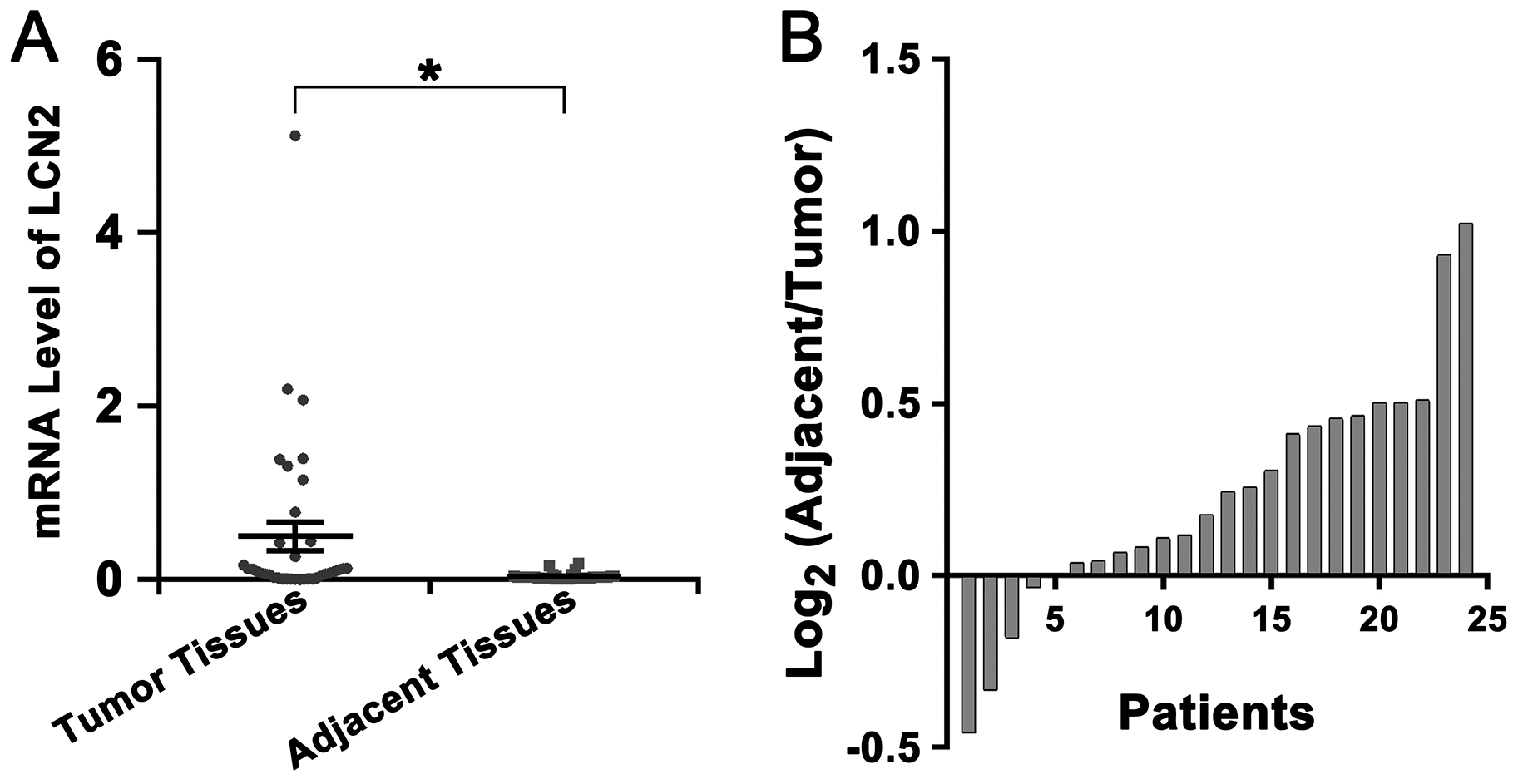 Up-regulation of LCN2 and decline of FA level in tumor tissues of HCC patients