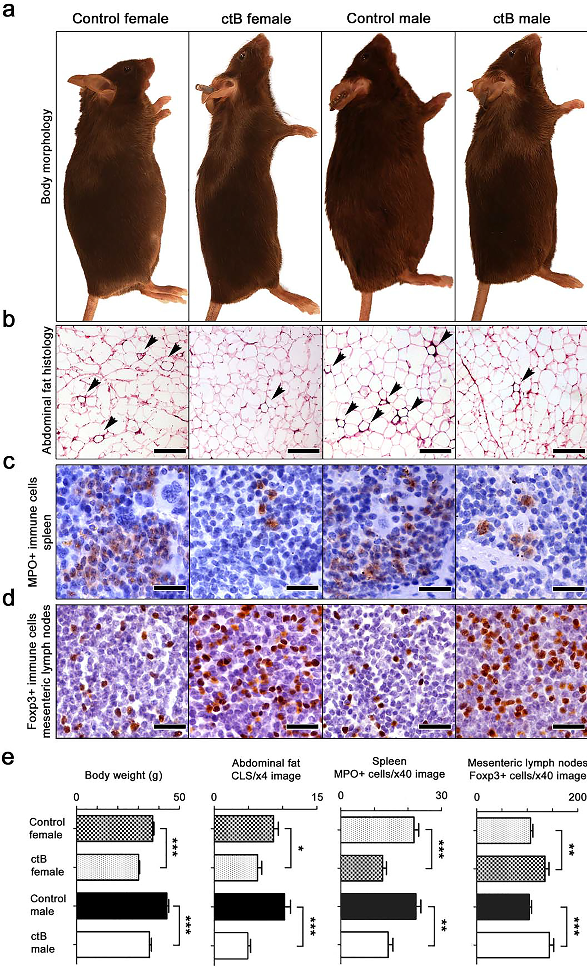 Early-life intervention with ctB rescues mice from age-associated obesity and inflammation