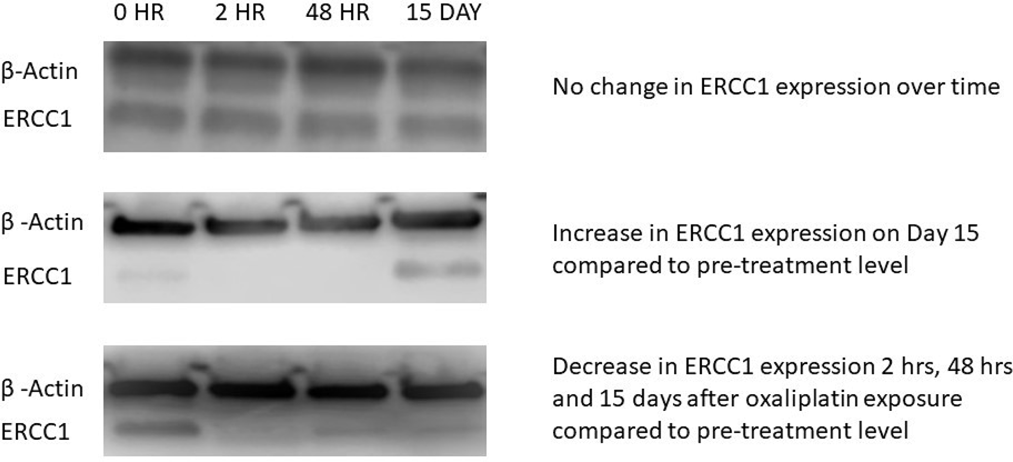 Western blot (WB) images from three representative patients