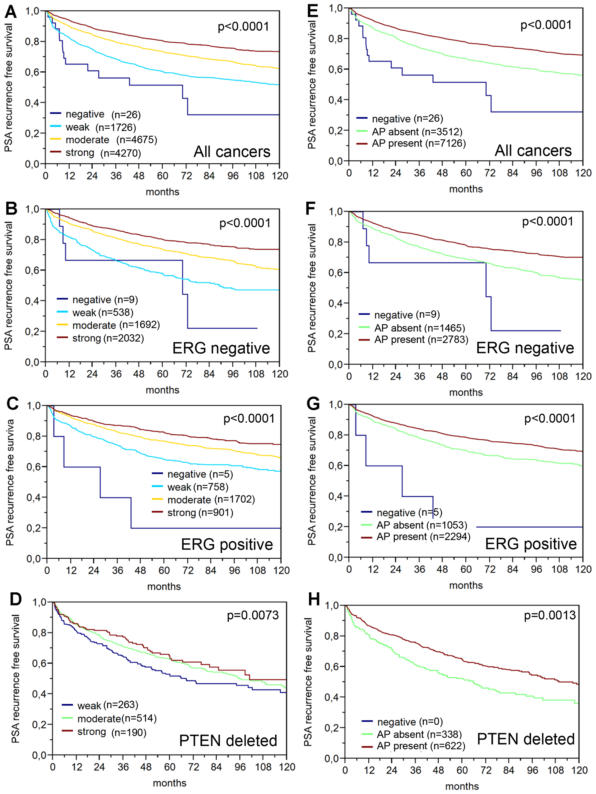 Prognostic relevance of PSA immunostaining (dilution 1:800) in prostate cancer