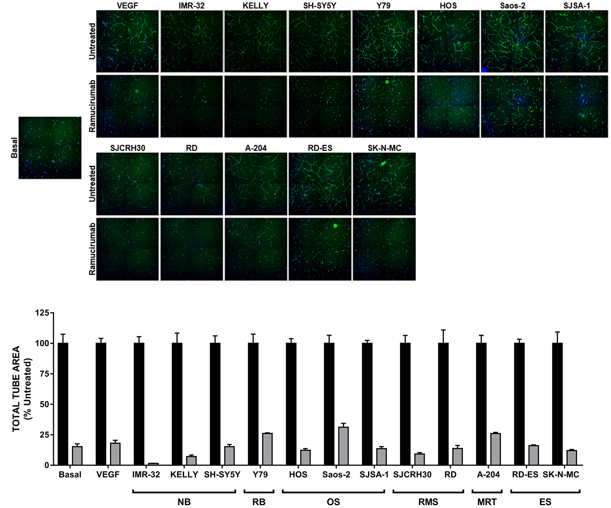 Ramucirumab blocks both VEGF-A- and pediatric tumor cell-driven cord formation in vitro