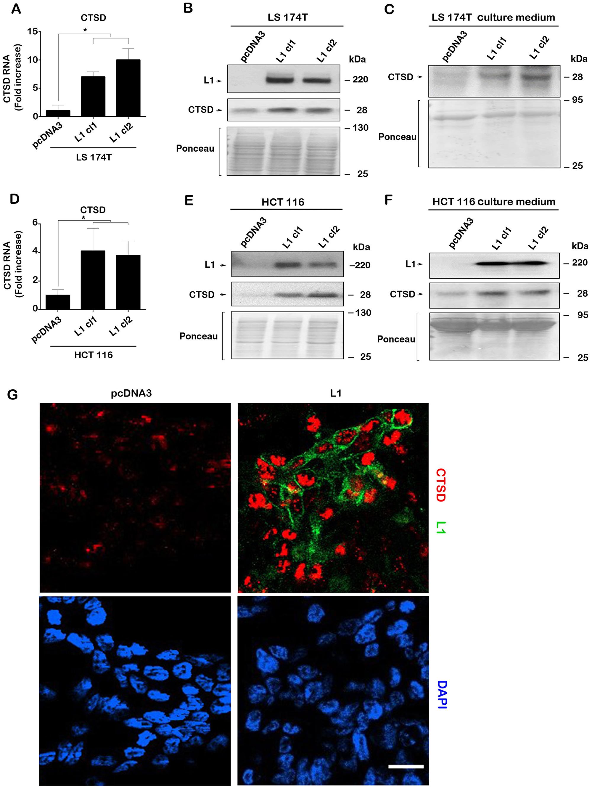 L1 overexpression in human CRC cell lines induces the expression of CTSD