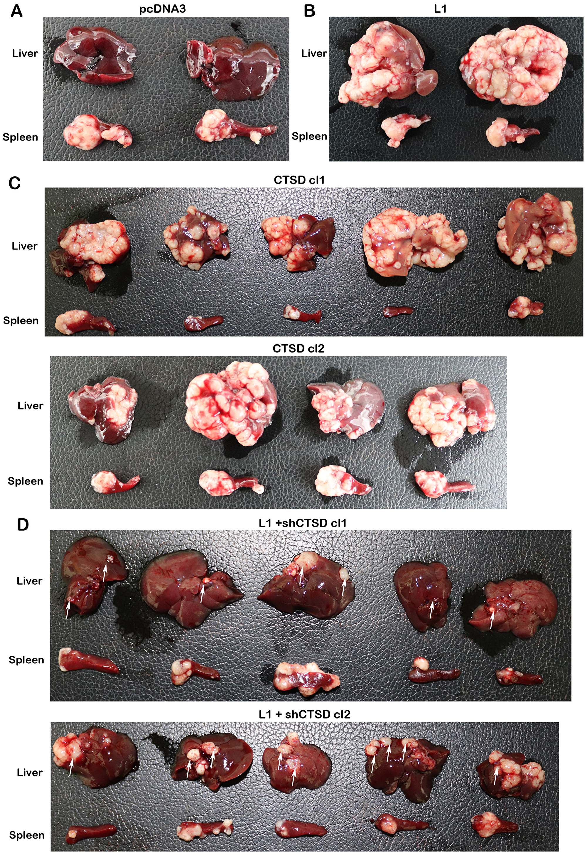 CTSD expression levels affect the metastatic ability of human CRC cells to the liver