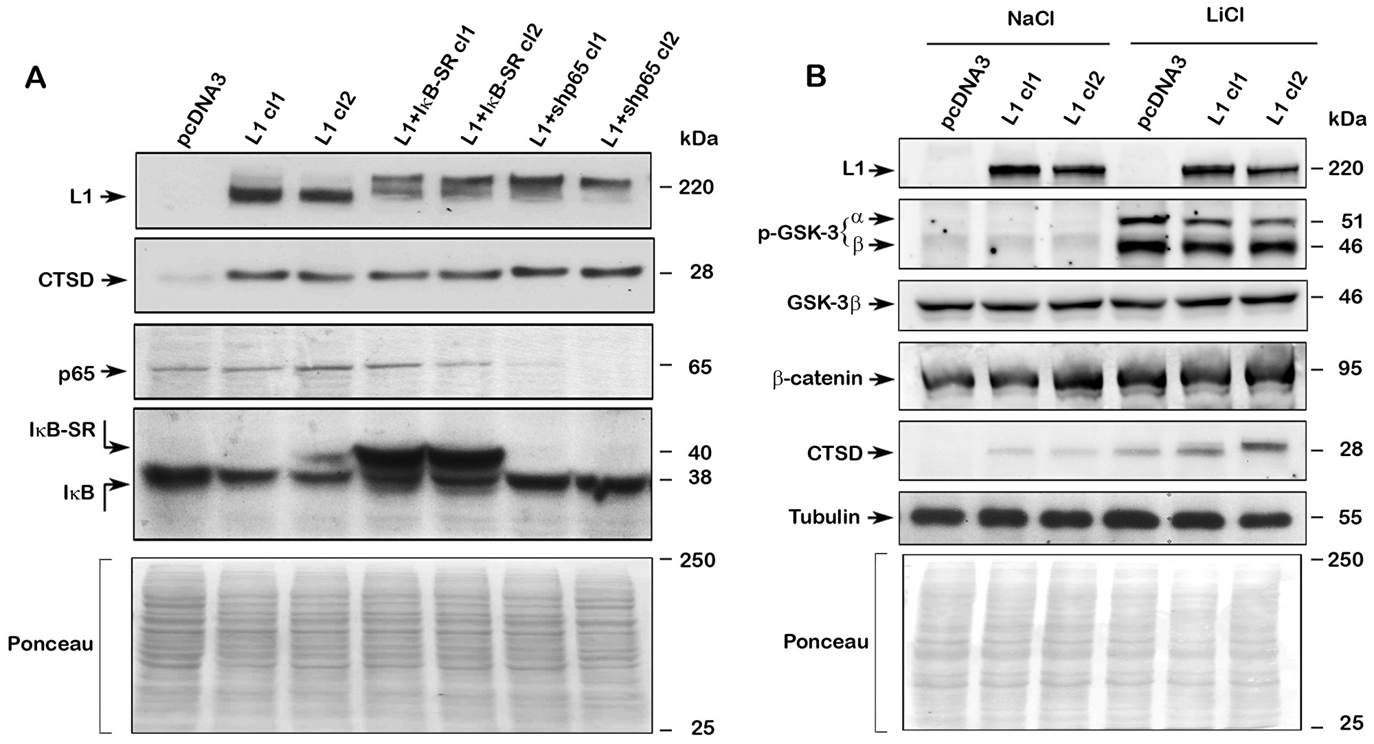 Regulation of CTSD expression by L1 does not involve NF-κB but is affected by Wnt/β-catenin signaling