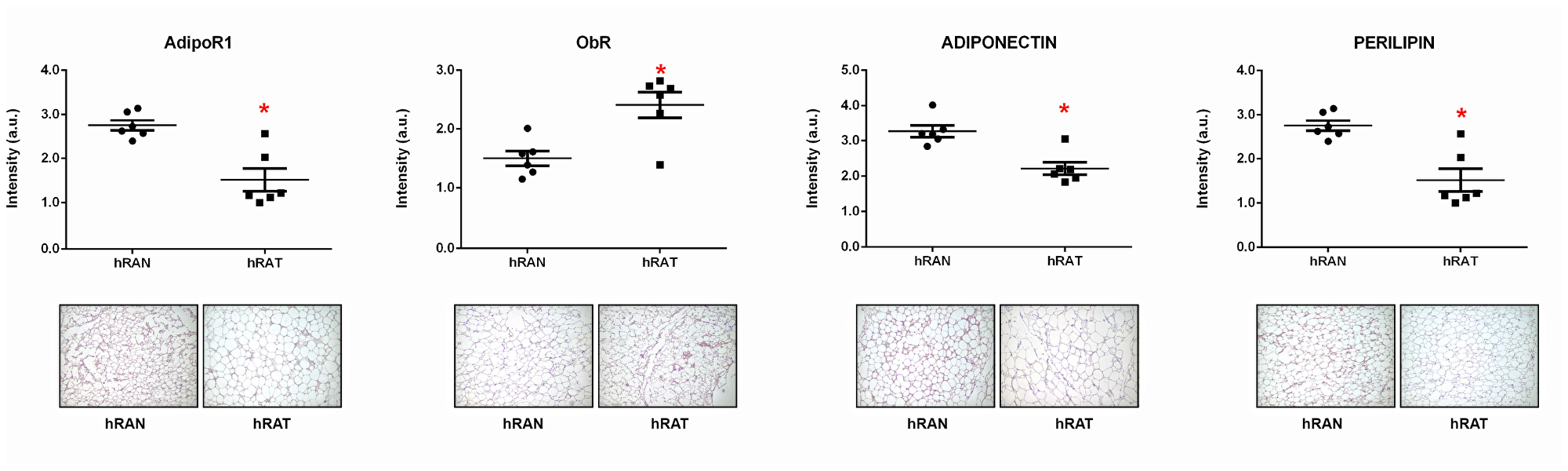 ObR, AdipoR1, adiponectin and perilipin 1 expression in the different adipose tissues
