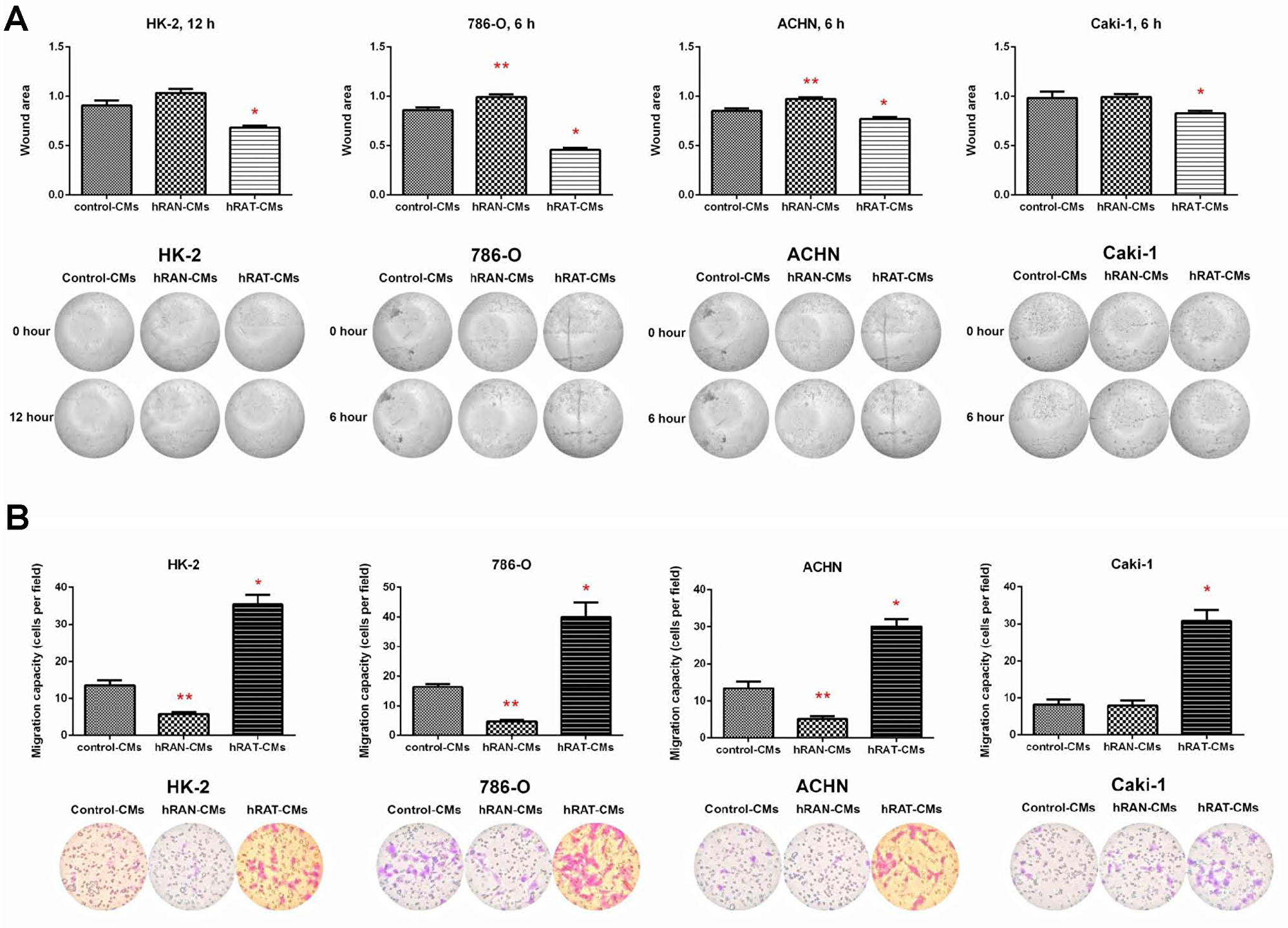Effect of CMs from hRAN and hRAT on migration of HK-2, 786-O, ACHN and Caki-1 cell lines