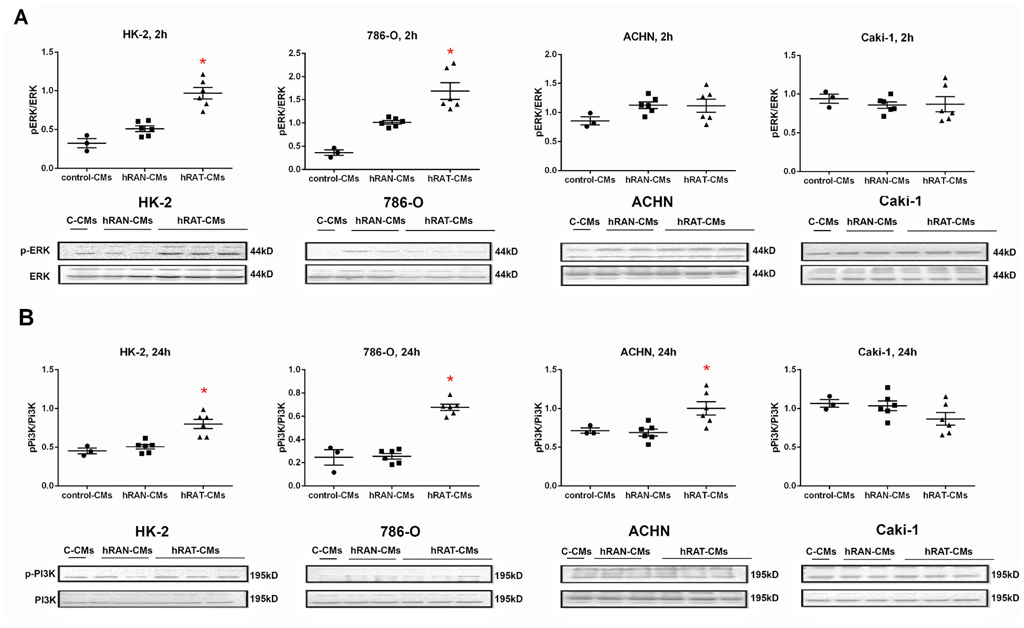 Effect of CMs from hRAN and hRAT on: pERK (A) and pPI3K (B) expression was evaluated in HK-2, 786-O, ACHN and Caki-1 cell lines. HK-2, 786-O, ACHN and Caki-1 cells were grown on 6 well plates, incubated for 24 hs with the different CMs and then lysed. Expression of the different proteins was measured by Western blot. ERK (A) and PI3K (B) were used as internal controls. Images were analyzed by densitometry Horizontal bars represent the geometric mean of each data set. Vertical bars indicate SEM. *p $!--ESC