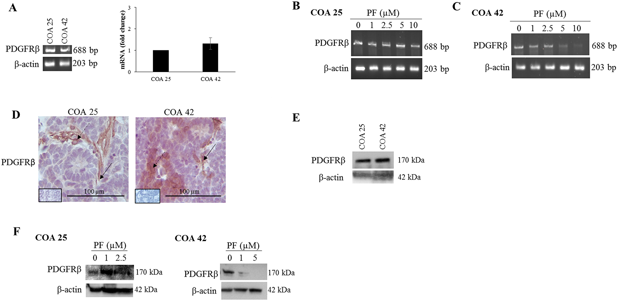 PF-573,228 (PF) inhibition of FAK altered PDGFRβ in COA 25 and COA 42 cells