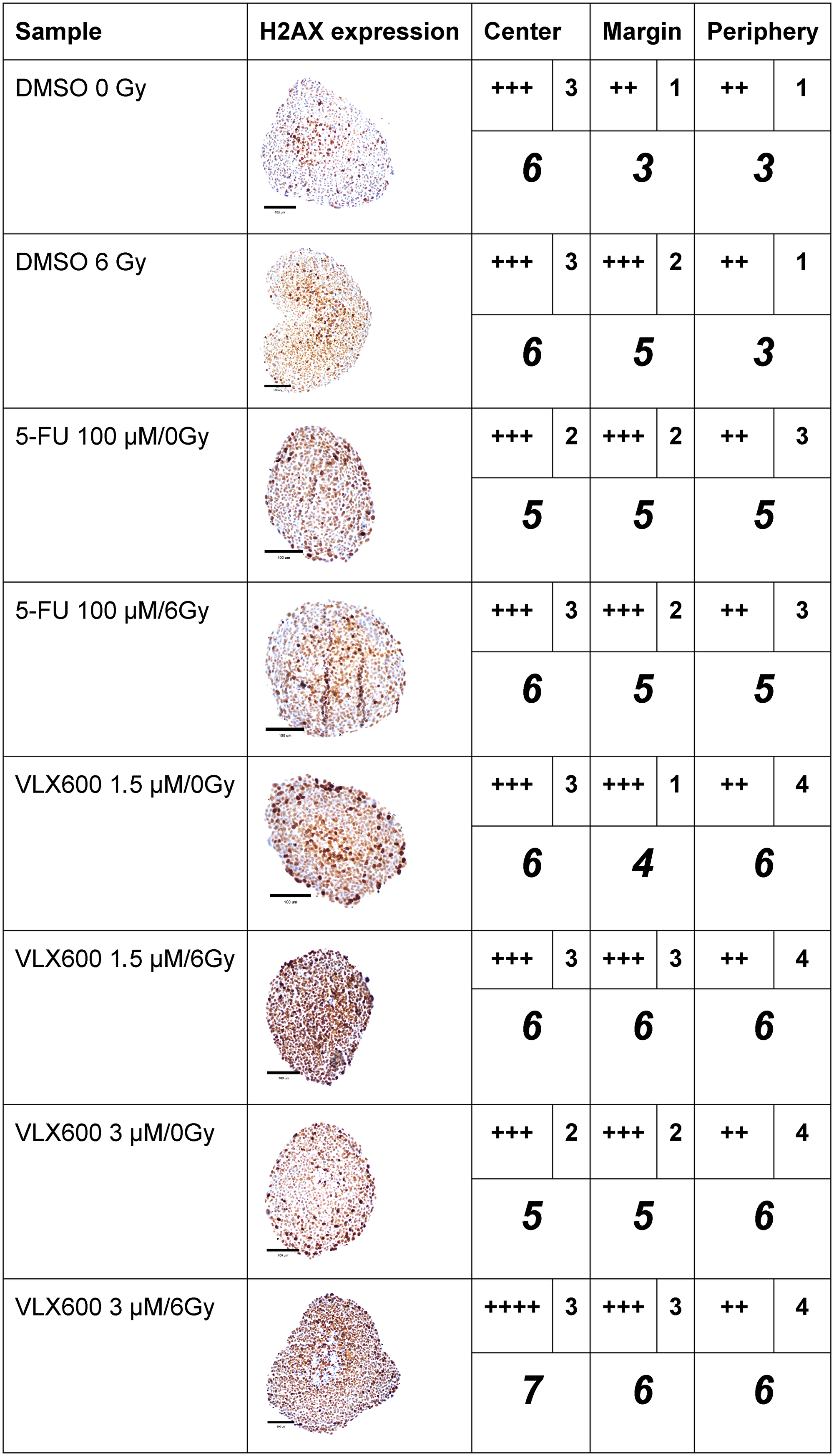 Immunohistochemical expression (centrally and peripherally in spheroids) of gamma-H2AX in HCT116 GFP cells cultured as spheroids for 7 days, then irradiated (6 Gy) at 4–6 h after addition of drug and harvested 24 h later