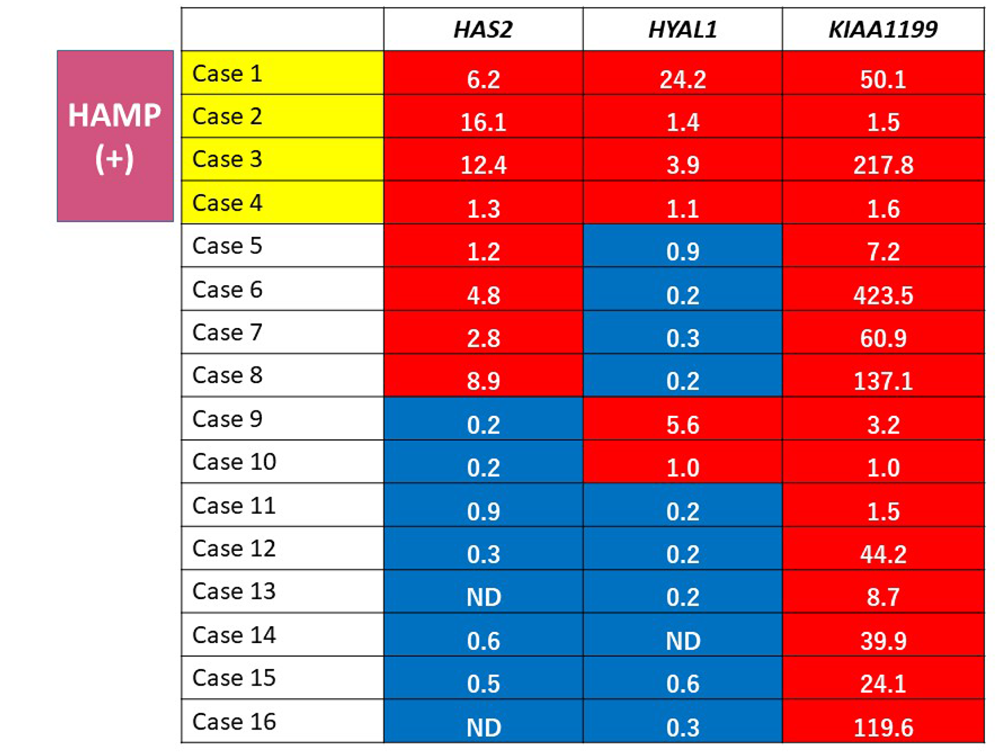 Gene expression profiling of HA metabolism genes in PDAC tissues