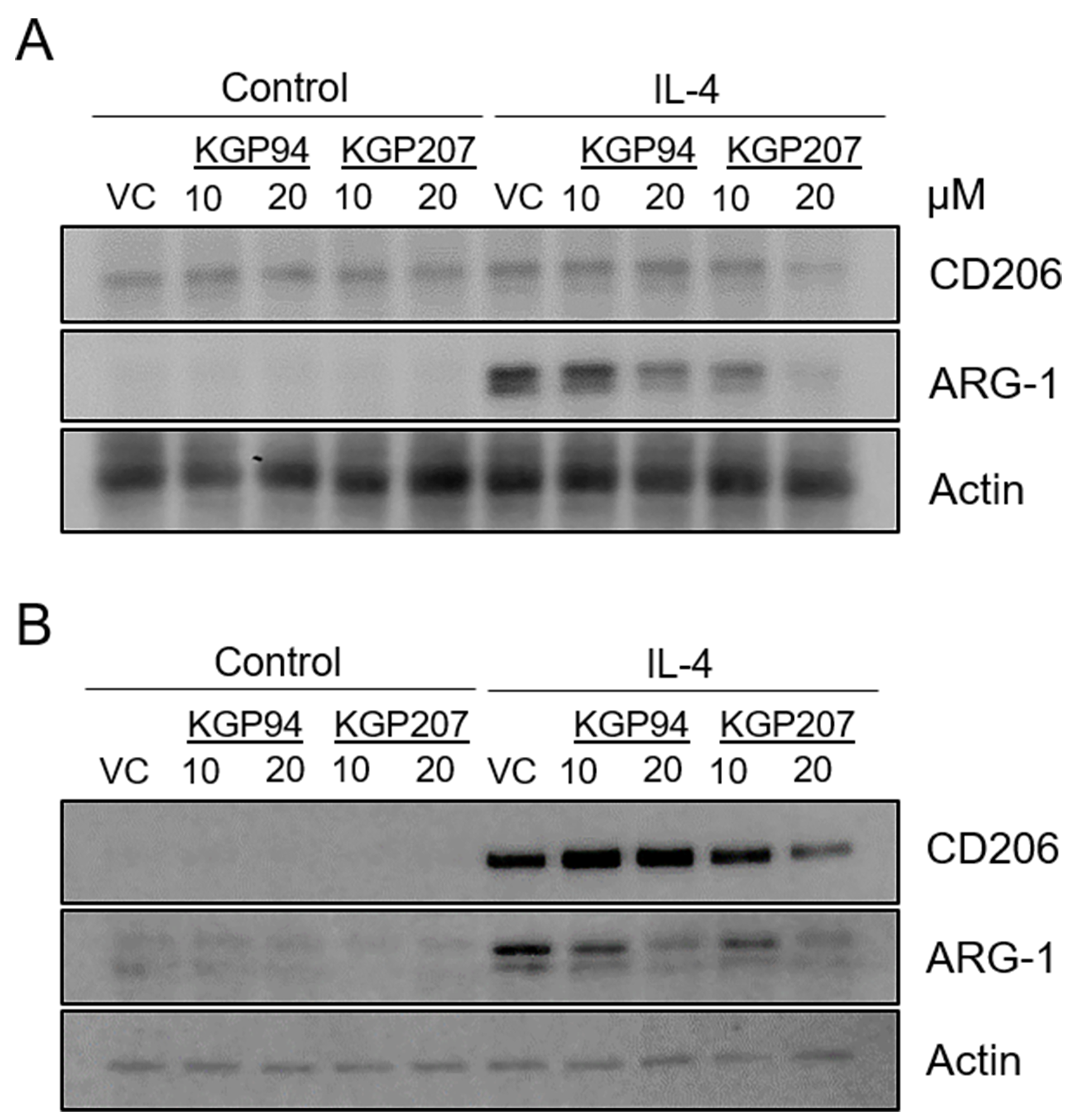 Cathepsin L inhibitors reduce expression of M2 markers