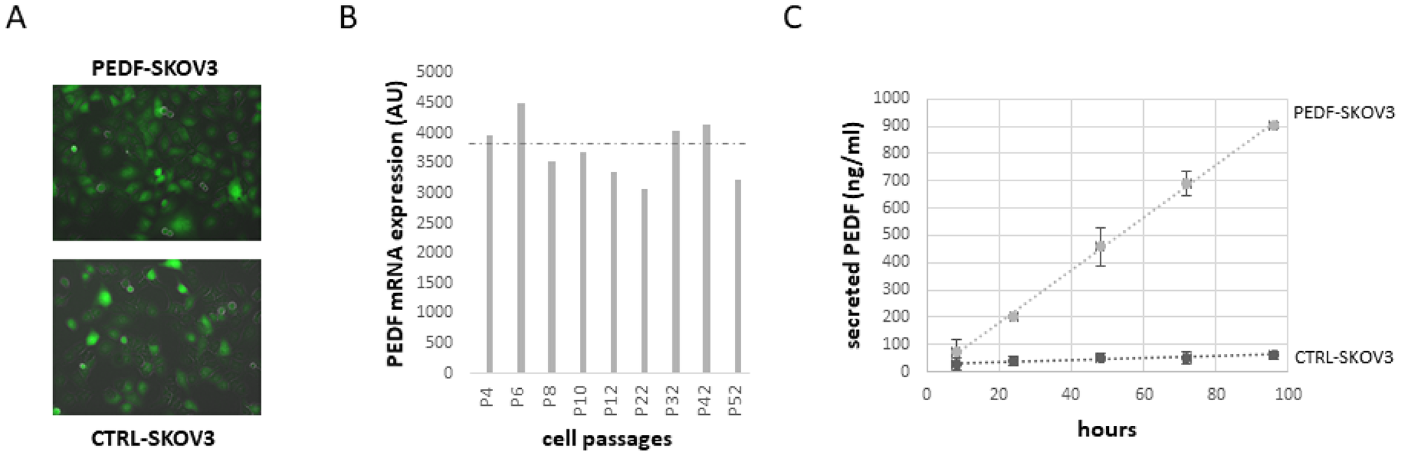 Expression of PEDF in SKOV3 cells stably transfected for PEDF with Sleeping Beauty Transposon (SBT) system