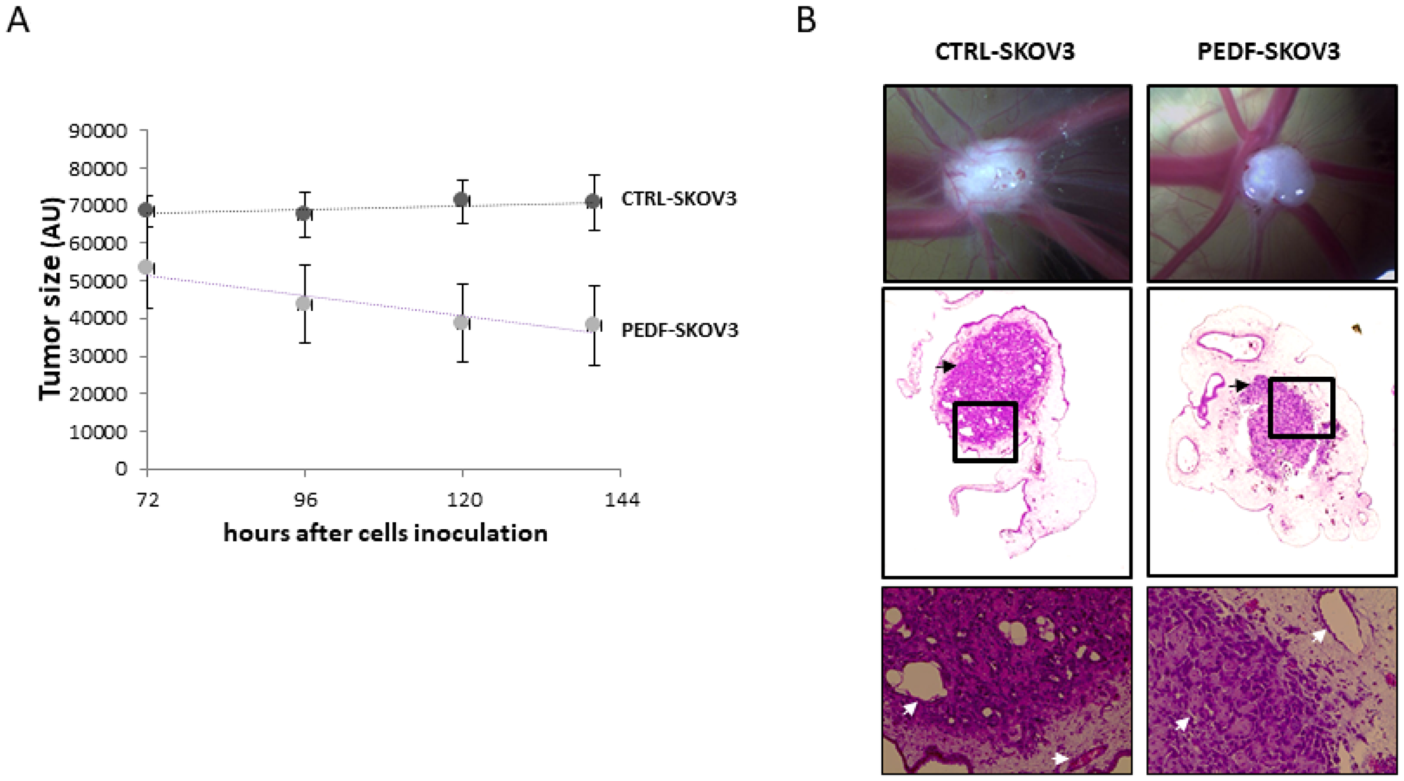 Tumorigenicity of PEDF-SKOV3 cells on CAM model