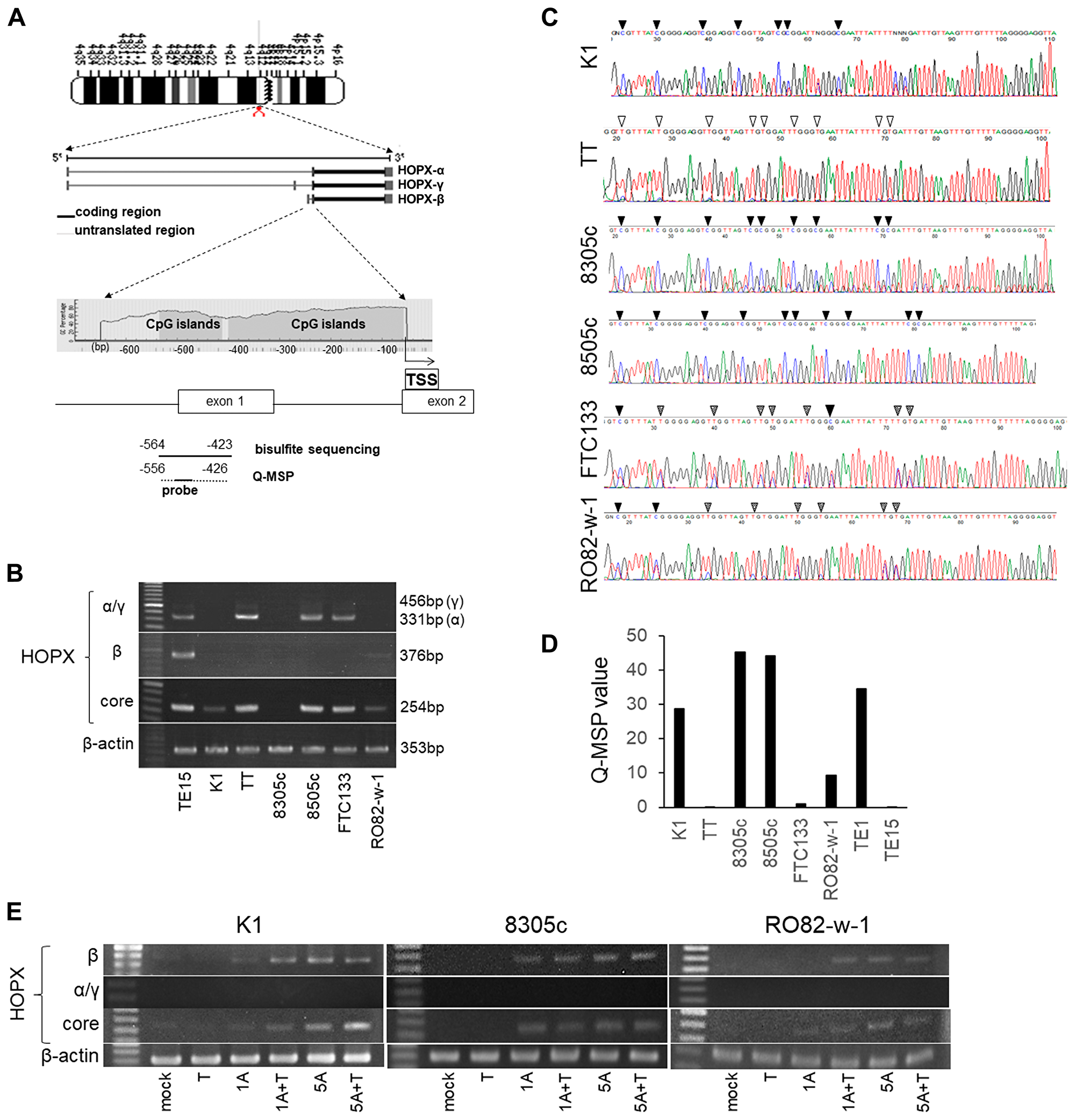 Analysis of promoter DNA methylation of HOPX and its expression in human papillary thyroid cancer (PTC) cell lines