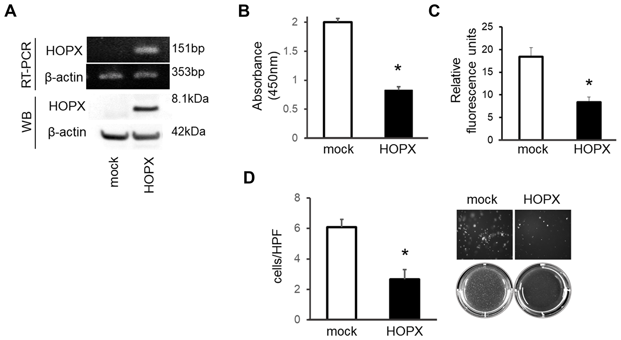 Tumor suppressive activities of HOPX in papillary thyroid cancer cell line