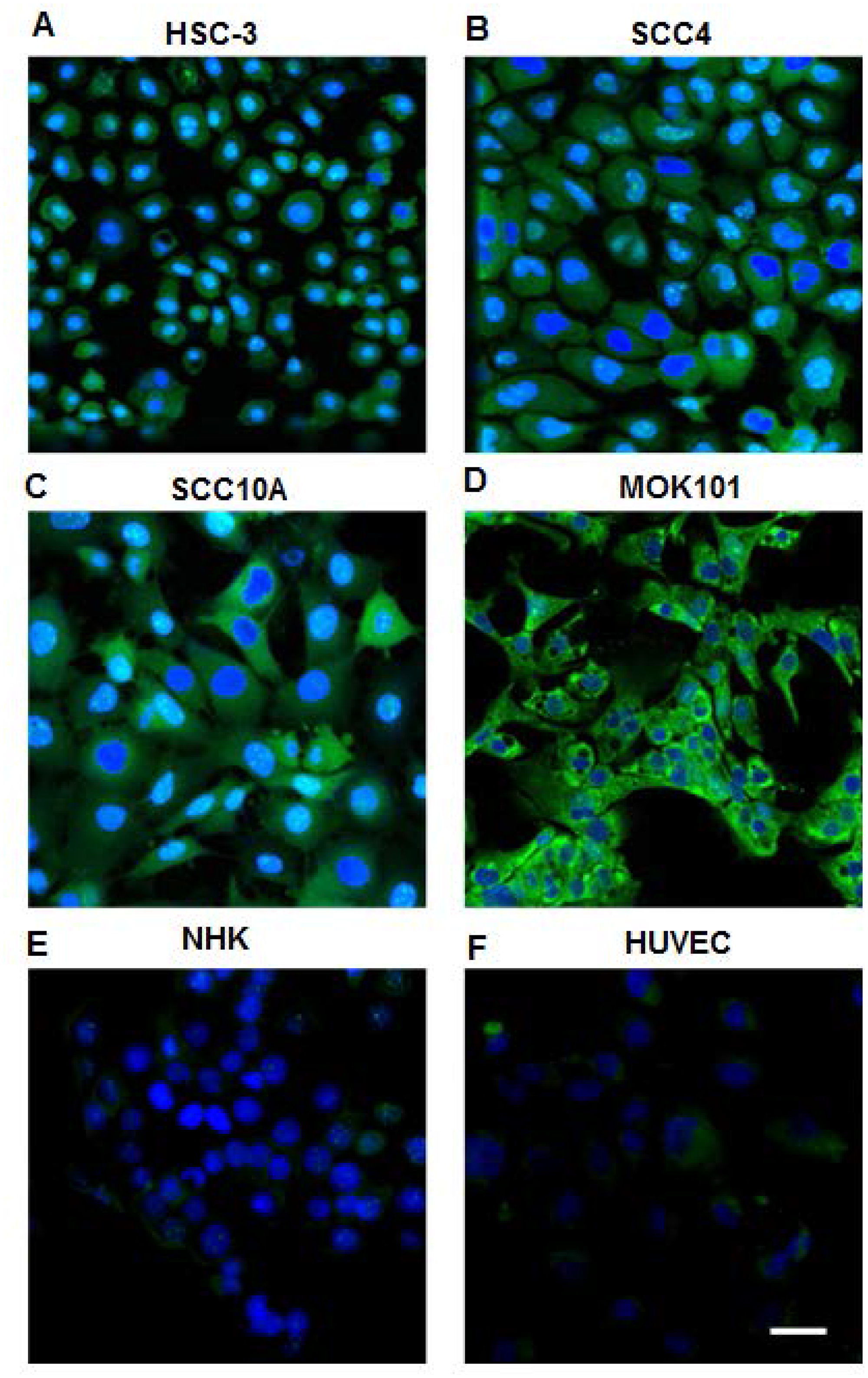 Confocal images of OSC cell lines and normal human cells stained by biotinylated LLY13/streptavidin-Alexa488