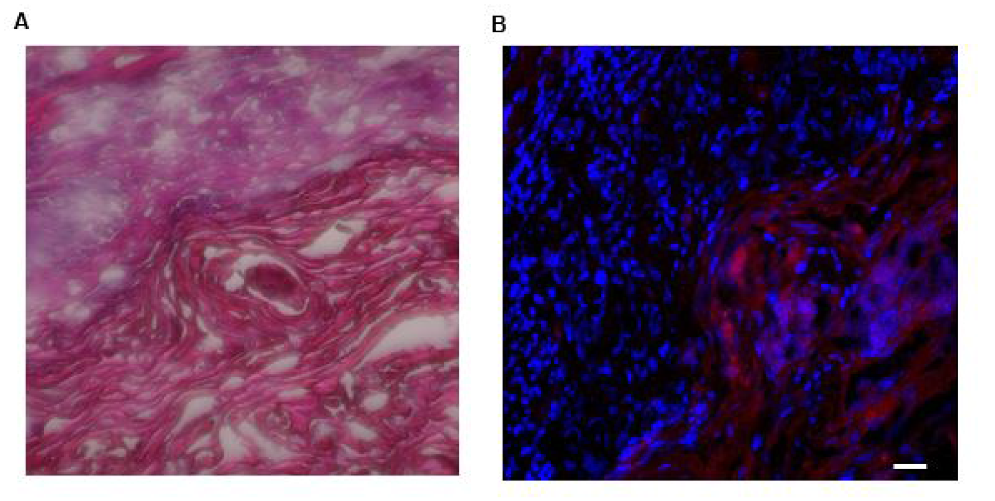 Photomicrographs of H&E staining of and LLY13-biotin/SA-Cy5.5 uptake into excised HSC3 implanted tongue tissues (20X)