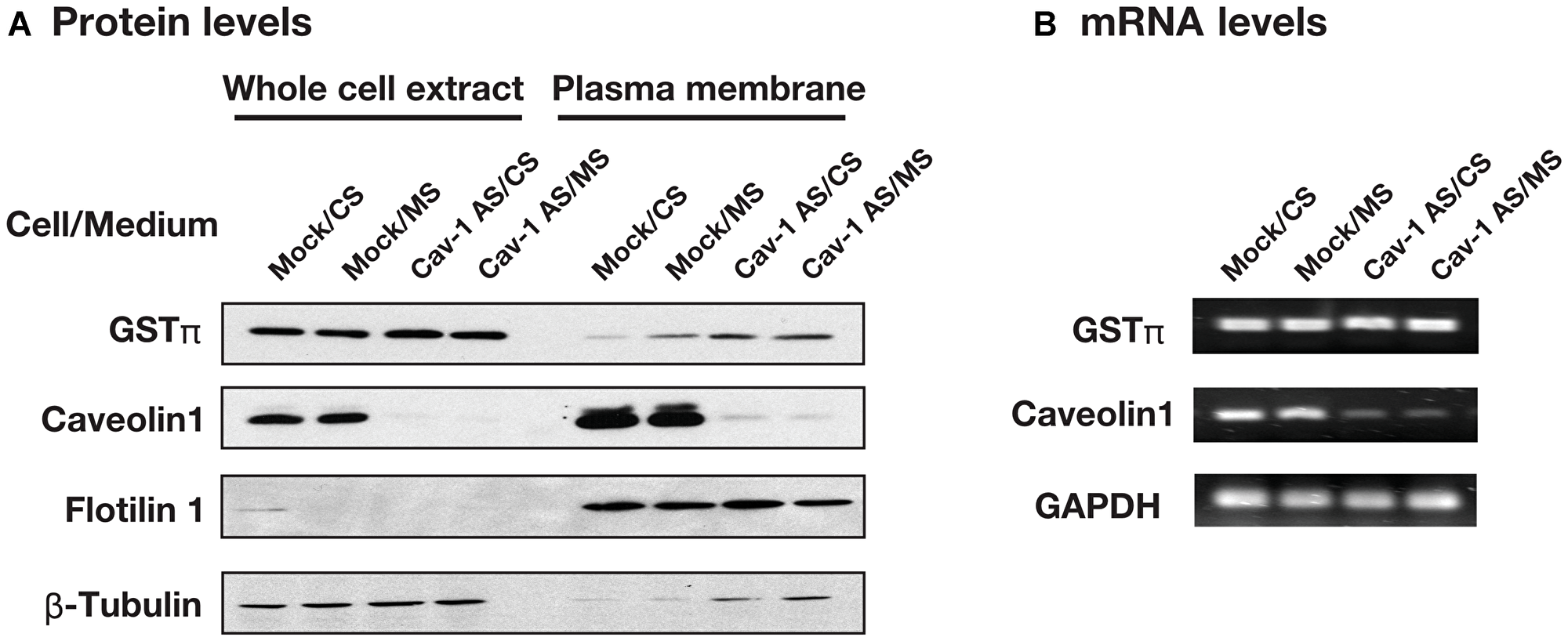 The effect of culture medium and caveolin-1 on the GSTπ expression