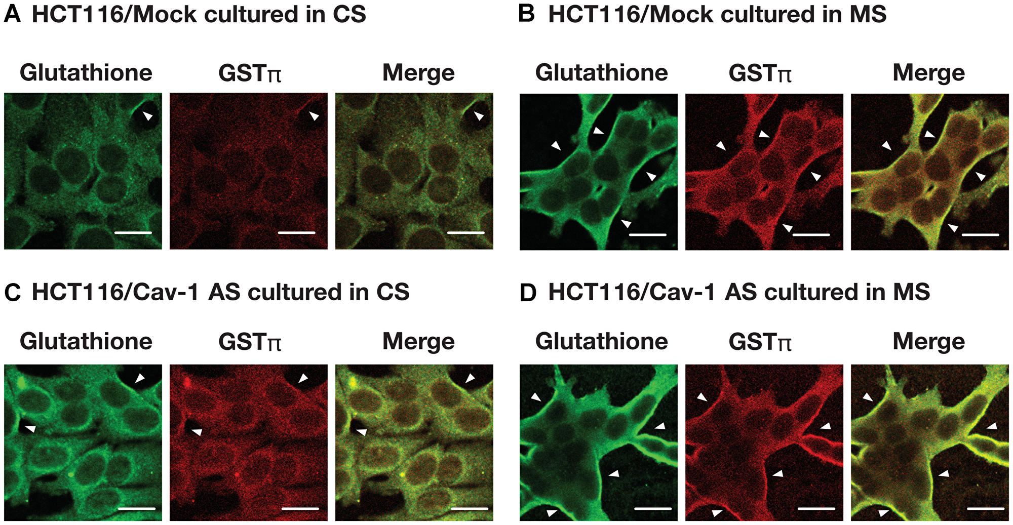 The effect of culture medium on S-glutathionylated protein and GSTπ levels