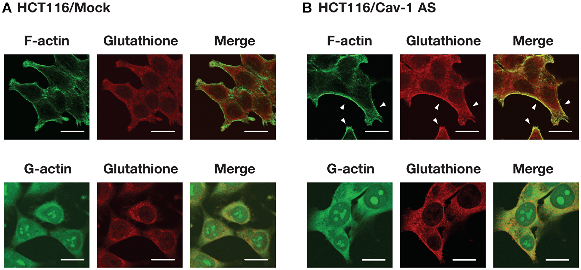 Cellular distribution of actin and S-glutathionylated protein