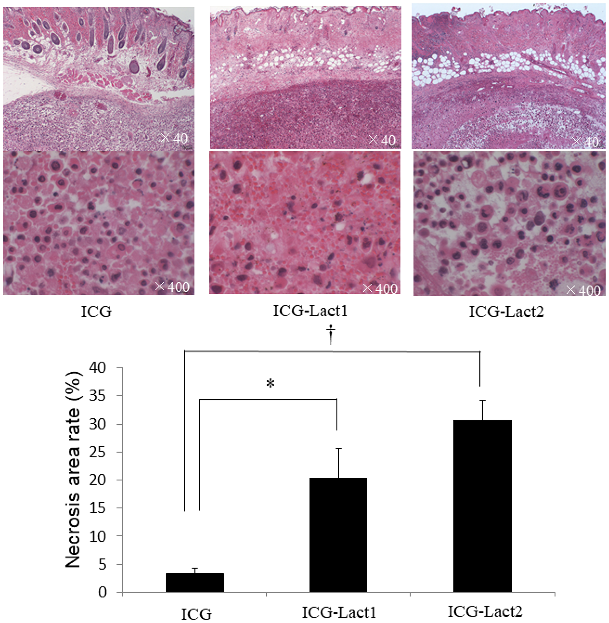 Effect of PDT on necrosis of subcutaneous tumors in the ICG and ICG-lactosomes mice