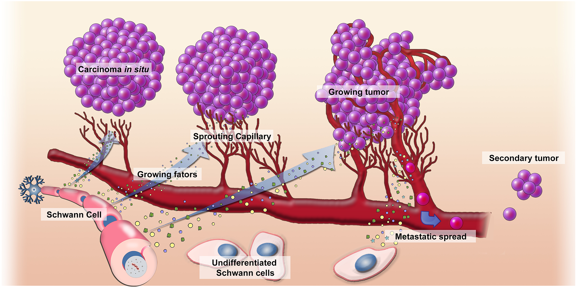Mechanism of action of Schwann cells in the development of cancer