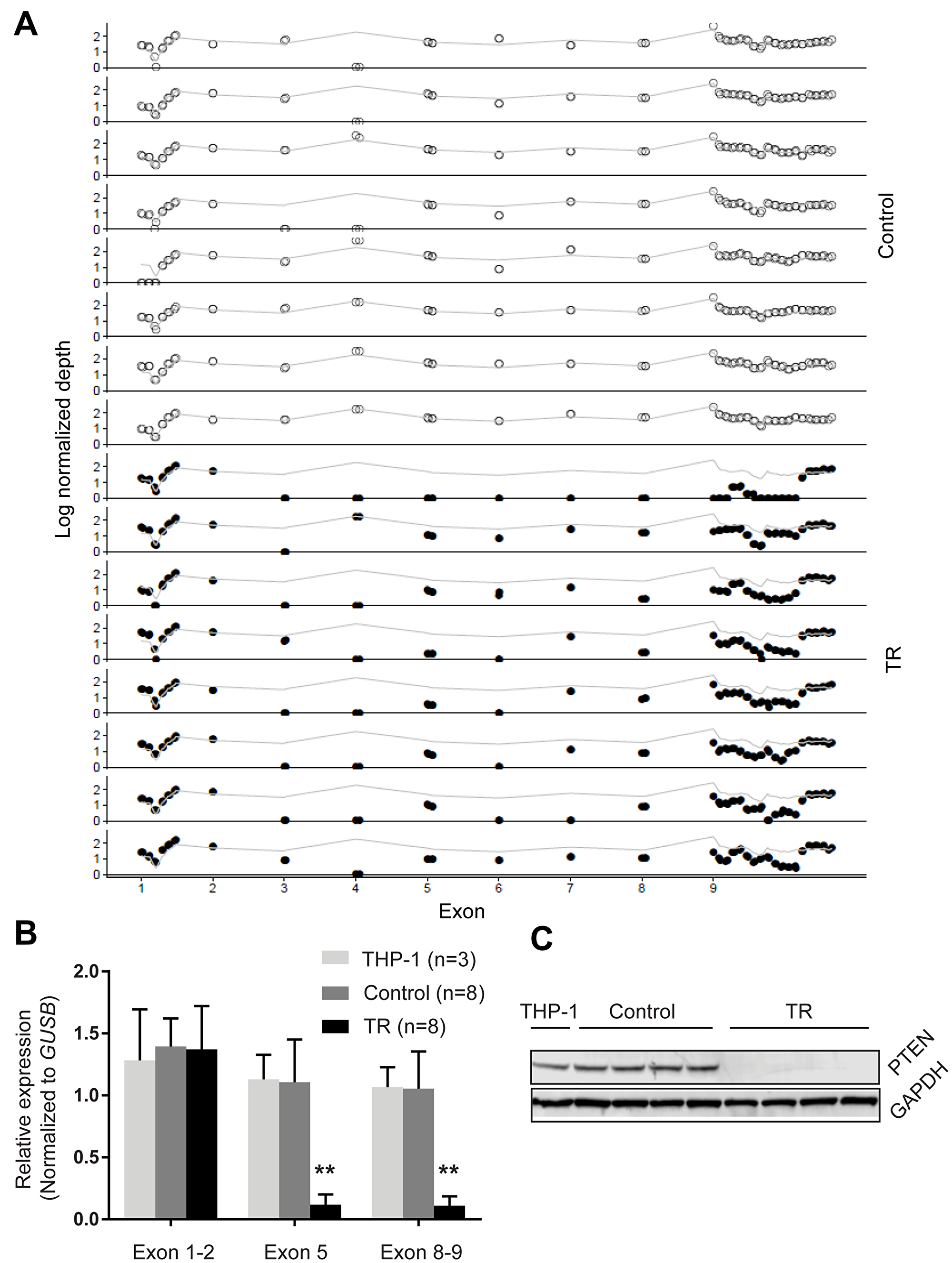 PTEN loss in TR cells
