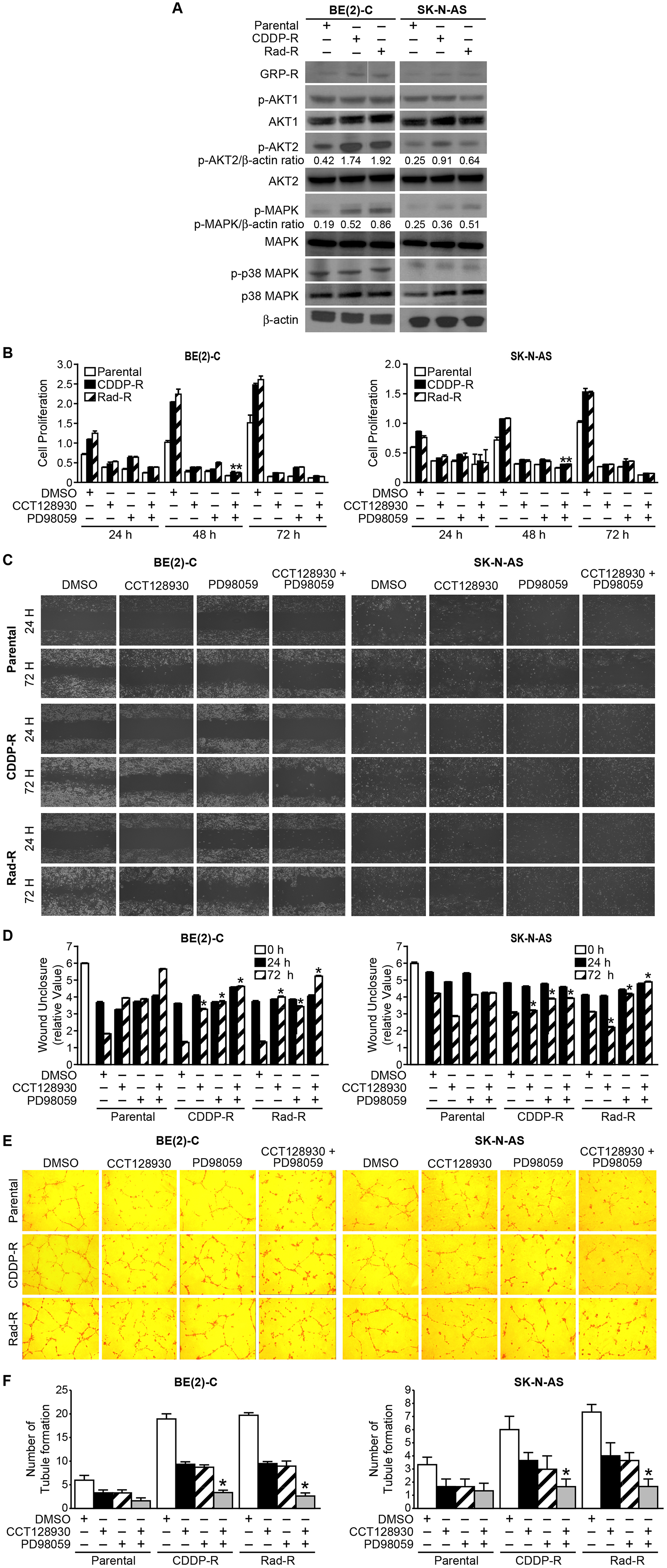 Activation of GRP-R/AKT2 and MAPK signaling pathways in CDDP-R/Rad-R BE(2)-C cells and CDDP-R/Rad-R SK-N-AS cells