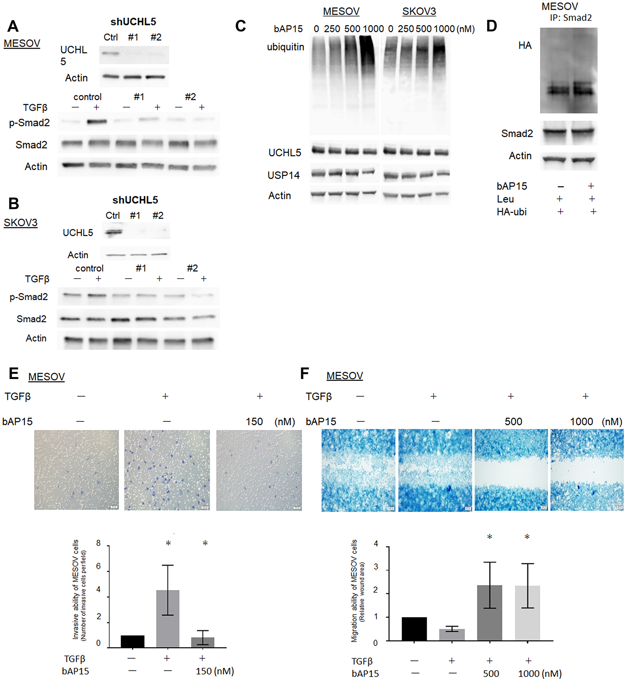 Knockdown of UCHL5 by shRNA suppresses phosphorylation of Smad2