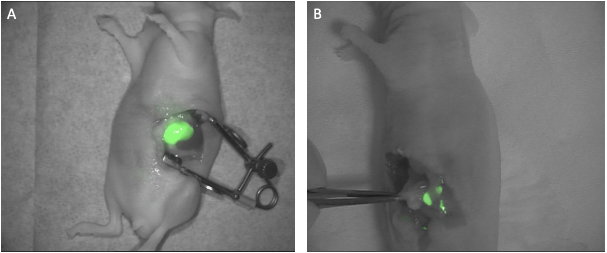 Fluorescent images of pancreatic tumors