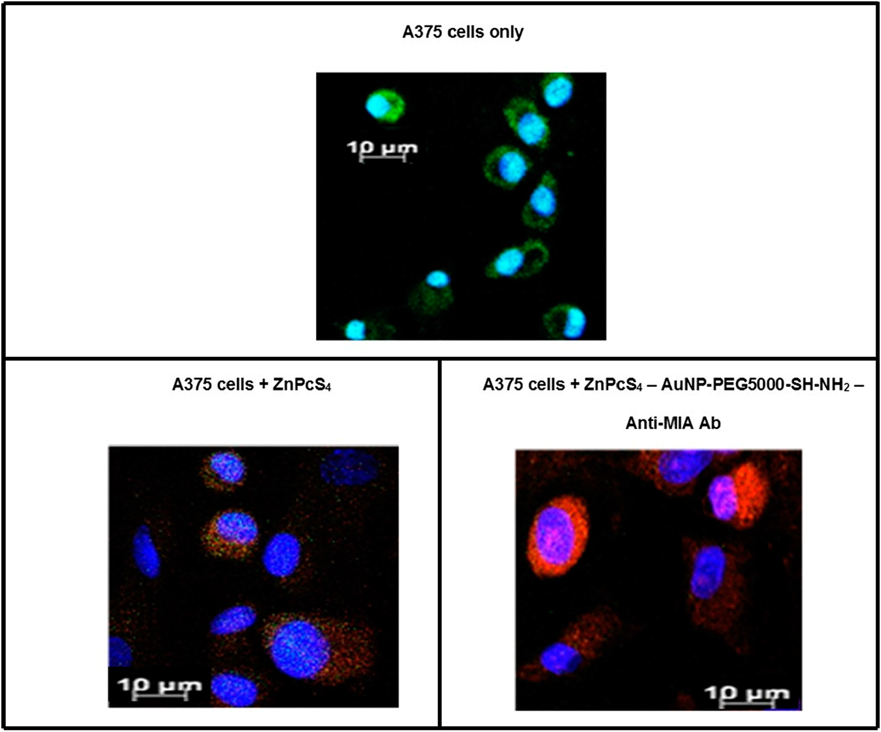 Subcellular localization results of ZnPcS4 PS alone verses PS drug conjugate within in vitro cultured MM cells. (Blue = nuclei, green = membrane proteins and red = localization of ZnPcS4 PS drug)