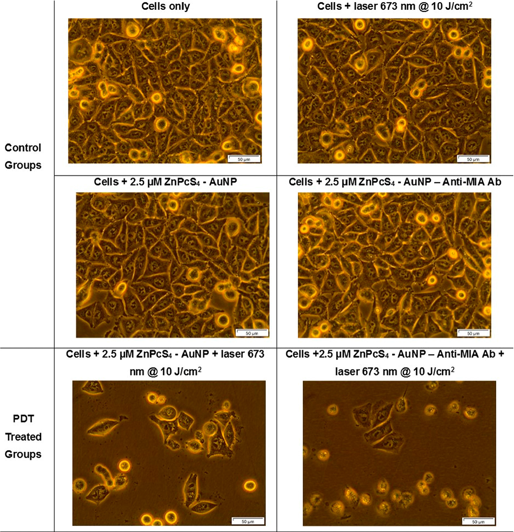 Light microscopy morphological images of MM cells at 400× magnification of control and experimental groups that were subjected to laser irradiation at a wavelength of 673 nm and a fluence of 10 J/cm2 during final PS drug conjugate PDT response assays