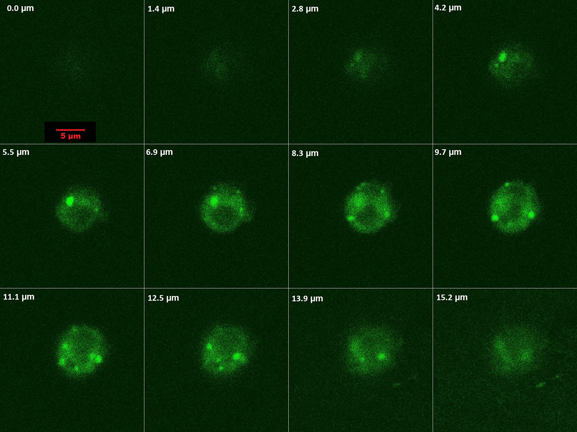Optical slicing / Z-stacking by confocal microscopy showing intracellular localization and distribution of of PMPCalcein in HL 60 cells